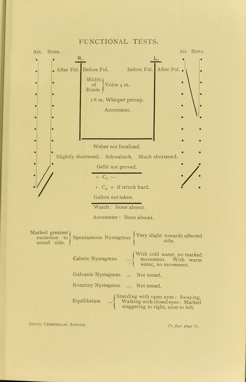 FUNCTIONAL TESTS. Air. Bone. Air. Bone. Watch: Bone absent. Acoumeter : Bone absent. Marked greatest i excursion to - Spontaneous Nystagmus sound side. J Caloric Nystagmus Galvanic Nystagmus Rotatory Nystagmus J Very slight towards affected I side. With cold water, no marked movement. With warm water, no movement. Not tested. Not tested. ( Standing with open eyes : Swaying. Equilibrium ...-^ Walking with closed eyes : Marked l staggering to right, soon to left. Otitic Cerebeu.ar Abscess To face page 62.