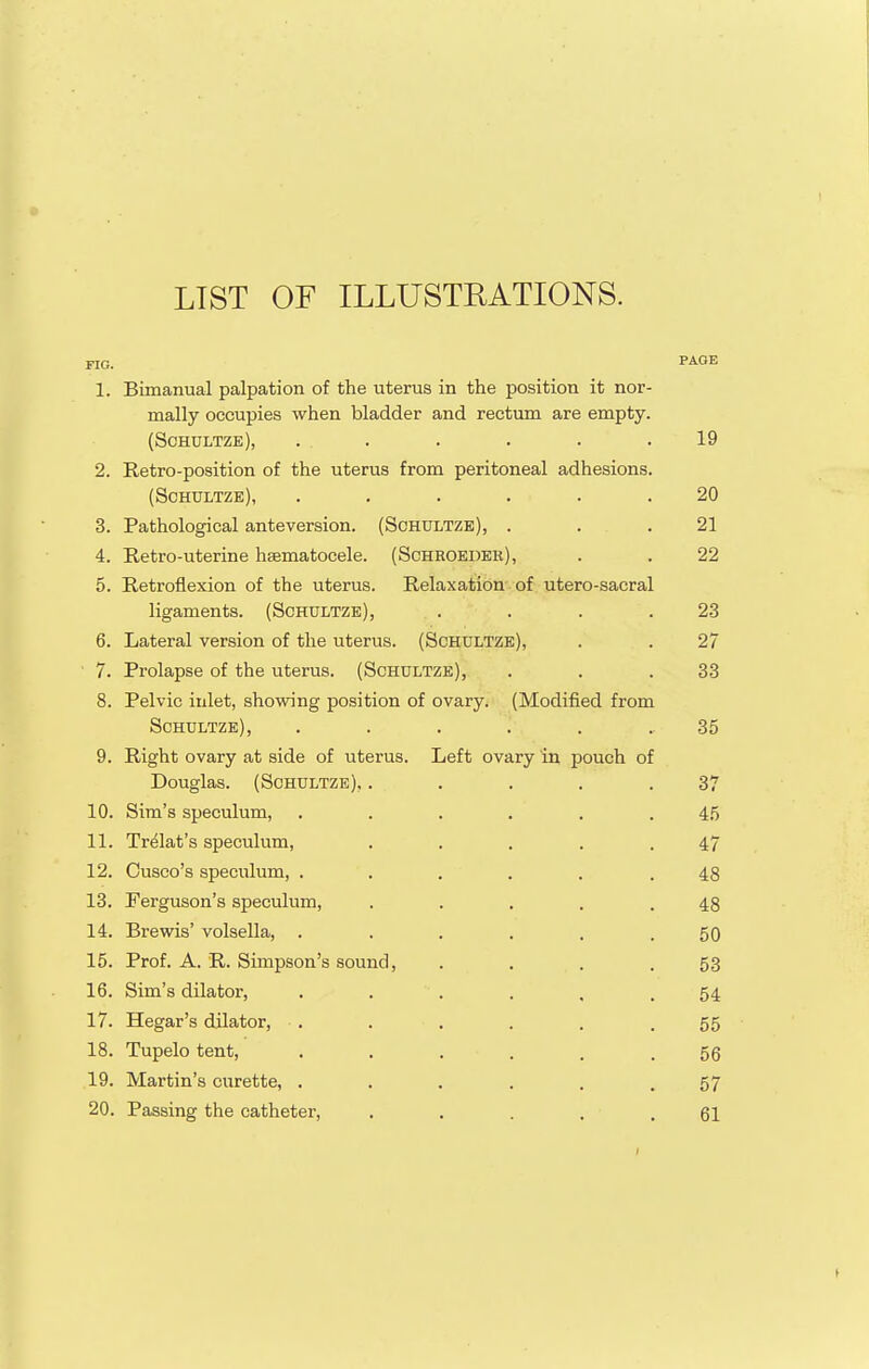 T Trim /^TTi TT T TTOT'TD A T'T/^ATQ LIST OF ILLUbiliAiKJJNb. FIG. PAGE 1. Bimanual palpation of the uterus in the position it nor- mally occupies when bladder and rectum are empty. (Schultze), ...... 2. Retro-position of the uterus from peritoneal adhesions. (Schultze), ...... OA 3. Pathological anteversion. (Schultze), . 21 4. Retro-uterine hsematocele. (Schroeder), 22 5. Retroflexion of the uterus. Relaxation of utero-sacral ligaments. (Schultze), .... Zo 6. Lateral version of the uterus. (Schultze), 7. Prolapse of the uterus. (Schultze), 33 8. Pelvic iulet, showing position of ovary. (Modified from KJ\jH\J Lt±/jDi J J ....... 00 Q R-icrht ovarv a,t m'dp of ntpnm Tjpft ov^iw iTi TinnpVi nf Douglas. (Schultze), ..... 37 10. Sim's speculum, ...... 45 11. Trelat's speculum, ..... 47 12. Cusco's speculum, ...... 48 13. Ferguson's speculum, ..... 48 14. Brewis' volsella, ...... 50 15. Prof. A. R. Simpson's sound, .... 53 16. Sim's dilator, 54 17. Hegar's dilator, . 55 18. Tupelo tent, ...... 56 19. Martin's curette, ...... 57 20. Passing the catheter, ..... 61