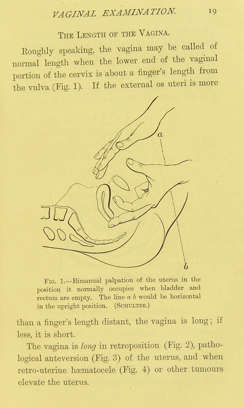 The Length of the Vagina. Koughly speaking, the vagina may be called of normal length when the lower end of the vaginal portion of the cervix is about a finger's length from the vulva (Fig. 1). If the external os uteri is more Fig. 1.—Bimanual palpation of the uterus in the position it normally occupies when bladder and rectum are empty. The line a b would be horizontal in the upright position. (Schultze.) than a finger's length distant, the vagina is long; if less, it is short. The vagina is long in retroposition (Fig. 2), patho- logical anteversion (Fig. 3) of the uterus, and when retro-uterine haematocele (Fig. 4) or other tumours elevate the uterus.