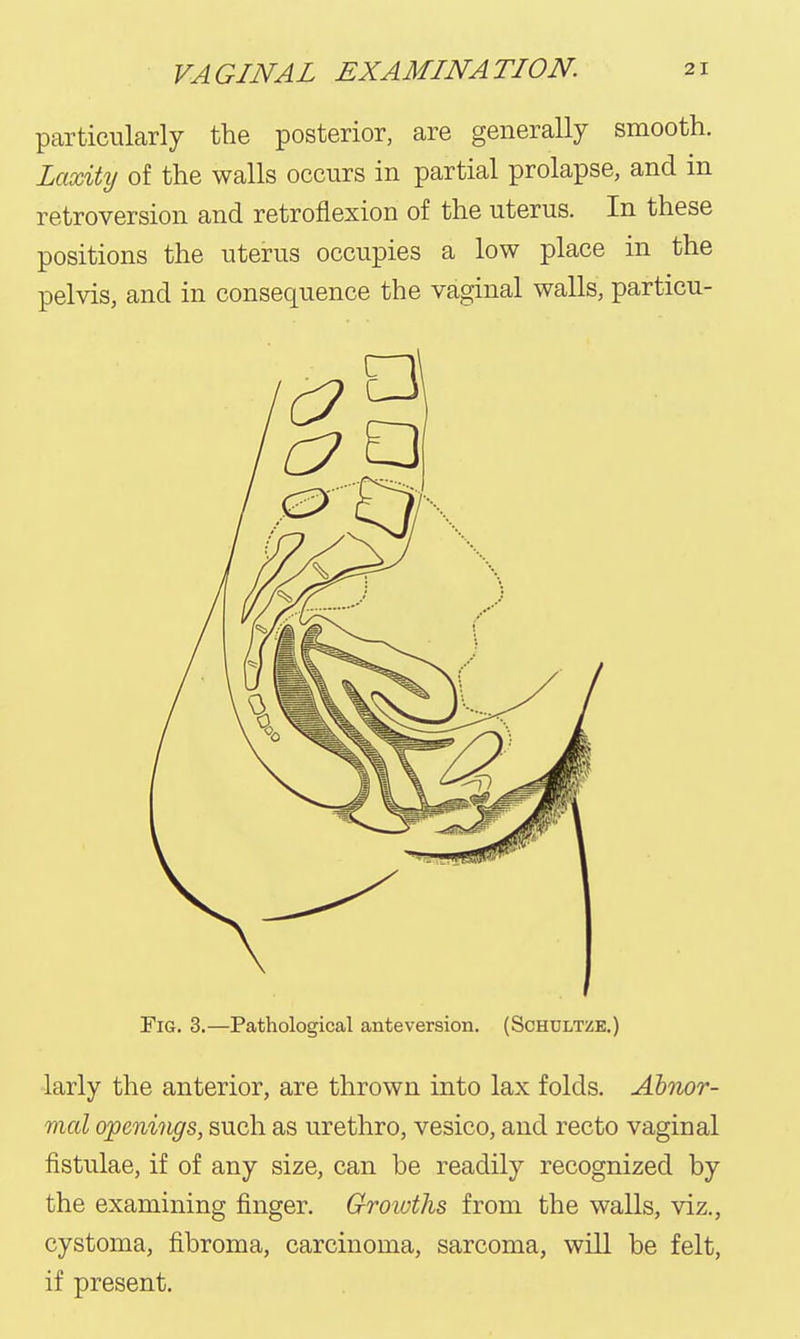 particularly the posterior, are generally smooth. Laxity of the walls occurs in partial prolapse, and in retroversion and retroflexion of the uterus. In these positions the uterus occupies a low place in the pelvis, and in consequence the vaginal walls, particu- FiG. 3.—Pathological anteversion. (Schdltze.) larly the anterior, are thrown into lax folds. Abnor- mal openings, such as urethro, vesico, and recto vaginal fistulae, if of any size, can be readily recognized by the examining finger. Groivths from the walls, viz., cystoma, fibroma, carcinoma, sarcoma, will be felt, if present.