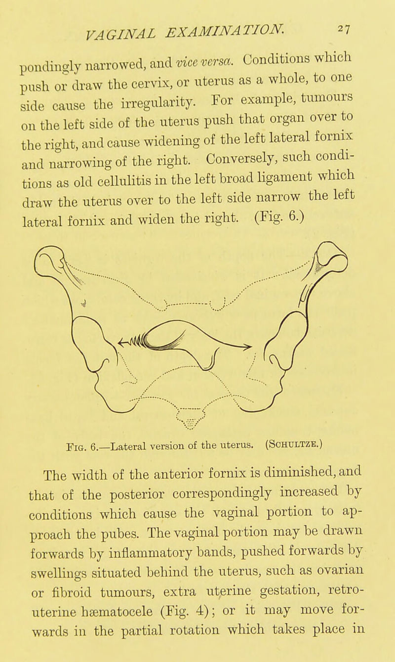 pondingly narrowed, and vice versa. Conditions which push or draw the cervix, or uterus as a whole, to one side cause the irregularity. For example, tumours on the left side of the uterus push that organ over to the right, and cause widening of the left lateral fornix and narrowing of the right. Conversely, such condi- tions as old cellulitis in the left hroad ligament which draw the uterus over to the left side narrow the left lateral fornix and widen the right. (Fig. 6.) Fig. 6.—Lateral version of the uterus. (Schultze.) The width of the anterior fornix is diminished, and that of the posterior correspondingly increased by conditions which cause the vaginal portion to ap- proach the pubes. The vaginal portion may be drawn forwards by inflammatory bands, pushed forwards by swellings situated behind the uterus, such as ovarian or fibroid tumours, extra uterine gestation, retro- uterine haematocele (Fig. 4); or it may move for- wards in the partial rotation which takes place in