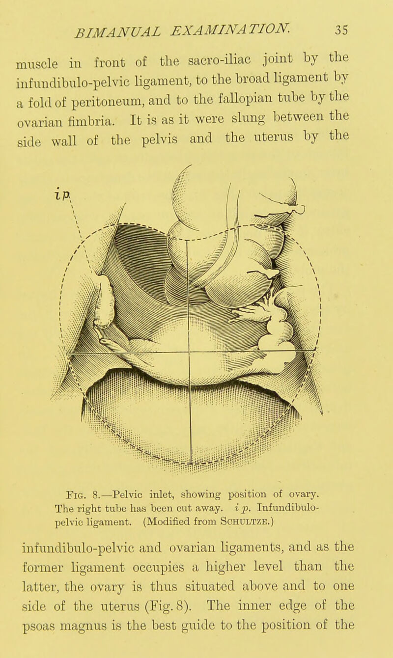 muscle in front of the sacro-iliac joint by the infundibulo-pelvic ligament, to the broad ligament by a fold of peritoneum, and to the fallopian tube by the ovarian fimbria. It is as it were slung between the side wall of the pelvis and the uterus by the Fig. 8.—Pelvic inlet, showing position of ovary. The right tube has been cut away, i p. Infundibulo- pelvic ligament. (Modified from Schultze.) infundibulo-pelvic and ovarian ligaments, and as the former ligament occupies a higher level than the latter, the ovary is thus situated above and to one side of the uterus (Fig. 8). The inner edge of the psoas magnus is the best guide to the position of the