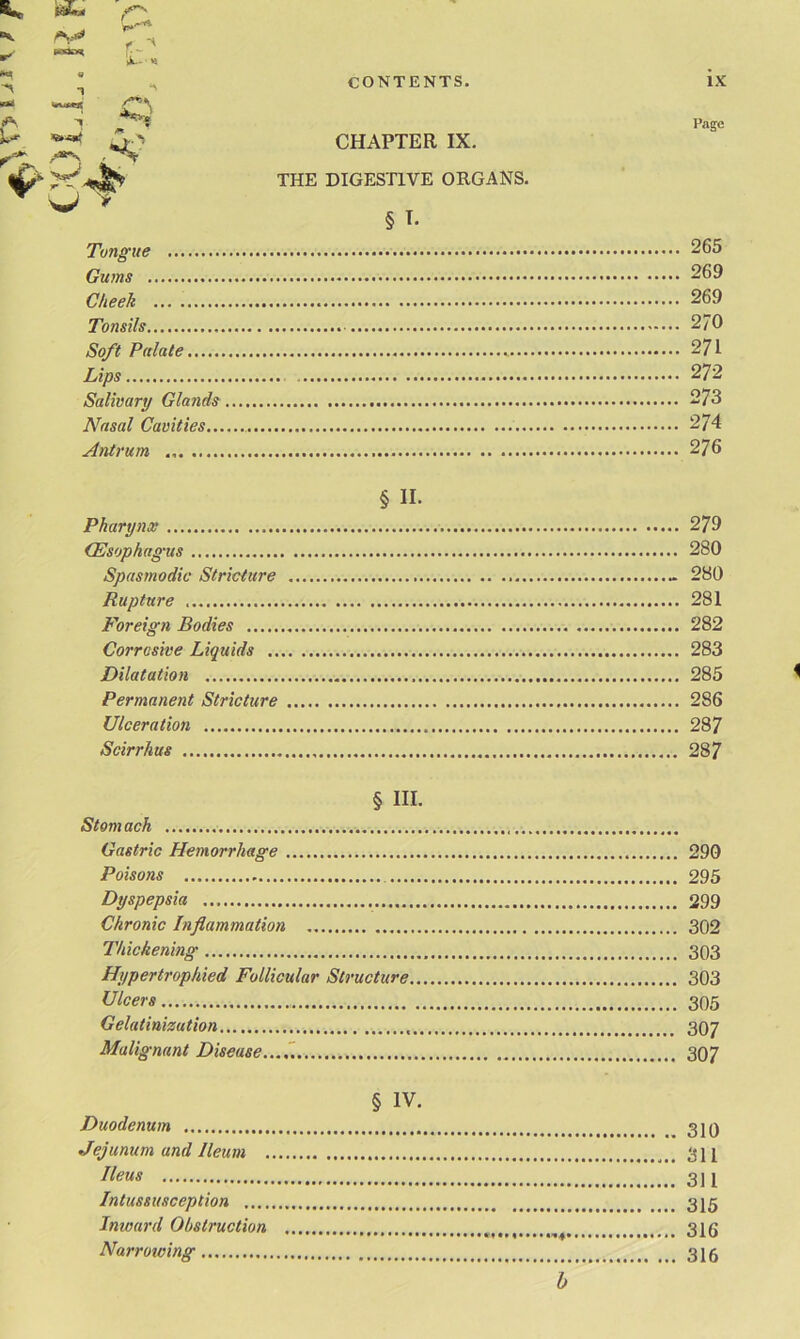 ^ « A T . * CONTENTS. r*i ^ CHAPTER IX. THE DIGESTIVE ORGANS. § I- Tongue 265 Gums 269 Cheek ... . 269 Tonsils 2/0 Soft Palate 271 Lips 272 Salivary Glands 273 Arasal Cavities 274 Antrum 276 § II. Pharynx (Esophagus Spasmodic Stricture Rupture Foreign Bodies Corrosive Liquids Dilatation Permanent Stricture Ulceration Scirrhus 279 280 280 281 282 283 285 < 286 287 287 § HI- Stom ach Gastric Hemorrhage 290 Poisons 295 Dyspepsia 299 Chronic Inflammation 302 Thickening 303 Hypertrophied Follicular Structure 303 Ulcers 305 Gelatinizution 3O7 Malignant Disease..... 307 § IV. Duodenum 310 Jejunum and Ileum 311 fleas 311 Intussusception 315 Inward Obstruction 316 Narrowing 315 b