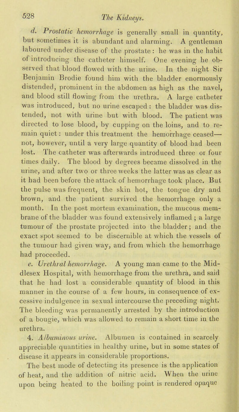 d. Prostatic hemorrhage is generally small in quantity, but sometimes it is abundant and alarming. A gentleman laboured under disease of the prostate: be was in the habit of introducing the catheter himself. One evening he ob- served that blood flowed with the urine. In the night Sir Benjamin Brodie found him with the bladder enormously distended, prominent in the abdomen as high as the navel, and blood still flowing from the urethra. A large catheter was introduced, but no urine escaped : the bladder was dis- tended, not with urine but with blood. The patient was directed to lose blood, by cupping on the loins, and to re- main quiet: under this treatment the hemorrhage ceased— not, how'ever, until a very large quantity of blood had been lost. The catheter was afterwards introduced three or four times daily. The blood by degrees became dissolved in the urine, and after two or three weeks the latter was as clear as it had been before the attack of hemorrhage took place. But the pulse was frequent, the skin hot, the tongue diy and brown, and the patient survived the hemorrhage only a month. In the post mortem examination, the mucous mem- brane of the bladder was found extensively inflamed ; a large tumour of the prostate projected into the bladder; and the exact spot seemed to be discernible at which the vessels of the tumour had given way, and from which the hemorrhage had proceeded. e. Urethral hemorrhage. A young man came to the Mid- dlesex Hospital, with hemorrhage from the urethra, and said that he had lost a considerable quantity of blood in this manner in the course of a few hours, in consequence of ex- cessive indulgence in sexual intercourse the preceding night. The bleeding w'as permanently arrested by the introduction of a bougie, which wras allowed to remain a short time in the urethra. 4. Albuminous urine. Albumen is contained in scarcely appreciable quantities in healthy urine, but in some states of disease it appears in considerable proportions. The best mode of detecting its presence is the application of heat, and the addition of nitric acid. When the urine upon being heated to the boiling point is rendered opaque