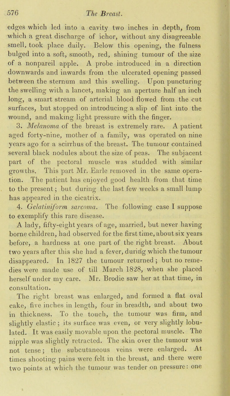 edges which led into a cavity two inches in depth, from which a great discharge of ichor, without any disagreeable smell, took place daily. Below this opening, the fulness bulged into a soft, smooth, red, shining tumour of the size of a nonpareil apple. A probe introduced in a direction downwards and inwards from the ulcerated opening passed between the sternum and this swelling. Upon puncturing the swelling with a lancet, making an aperture half an inch long, a smart stream of arterial blood flowed from the cut surfaces, but stopped on introducing a slip of lint into the wound, and making light pressure with the finger. 3. Melanoma of the breast is extremely rare. A patient aged forty-nine, mother of a family, was operated on nine years ago for a scirrhus of the breast. The tumour contained several black nodules about the size of peas. The subjacent part of the pectoral muscle was studded with similar growths. This part Mr. Earle removed in the same opera- tion. The patient has enjoyed good health from that time to the present; but during the last few weeks a small lump has appeared in the cicatrix. 4. Gelatiniform sarcoma. The following case I suppose to exemplify this rare disease. A lady, fifty-eight years of age, married, but never having borne children, had observed for the first time, about six years before, a hardness at one part of the right breast. About two years after this she had a fever, during which the tumour disappeared. In 1827 the tumour returned ; but no reme- dies were made use of till March 1828, when she placed herself under my care. Mr. Brodie saw her at that time, in consultation. The right breast was enlarged, and formed a flat oval cake, five inches in length, four in breadth, and about two in thickness. To the touch, the tumour was firm, and slightly elastic ; its surface was even, or very slightly lobu- lated. It was easily movable upon the pectoral muscle. The nipple was slightly retracted. The skin over the tumour was not tense; the subcutaneous veins were enlarged. At times shooting pains were felt in the breast, and there were two points at which the tumour was tender on pressure: one