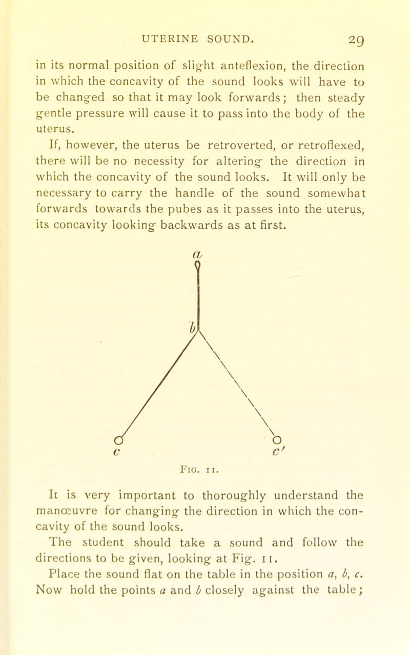 in its normal position of slight anteflexion, the direction in which the concavity of the sound looks will have to be changed so that it may look forwards; then steady gentle pressure will cause it to pass into the body of the uterus. If, however, the uterus be retroverted, or retroflexed, there will be no necessity for altering the direction in which the concavity of the sound looks. It will only be necessary to carry the handle of the sound somewhat forwards towards the pubes as it passes into the uterus, its concavity looking backwards as at first. CL Q Fig. II. It is very important to thoroughly understand the manoeuvre for changing the direction in which the con- cavity of the sound looks. The student should take a sound and follow the directions to be given, looking at Fig. 11. Place the sound flat on the table in the position a, b, c. Now hold the points a and (5 closely against the table;