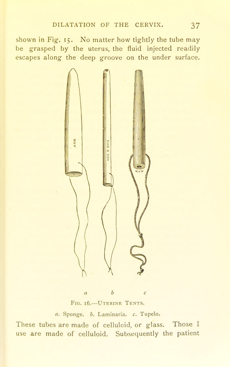 shown in Fig. 15. No matter how tightly the tube may be grasped by the uterus, the fluid injected readily escapes along the deep groove on the under surface. Fig. 16.—Uterine Tents. a. Sponge, b. Laminaria. c. Tupelo. These tubes are made of celluloid, or glass. Those I use are made of celluloid. Subsequently the patient