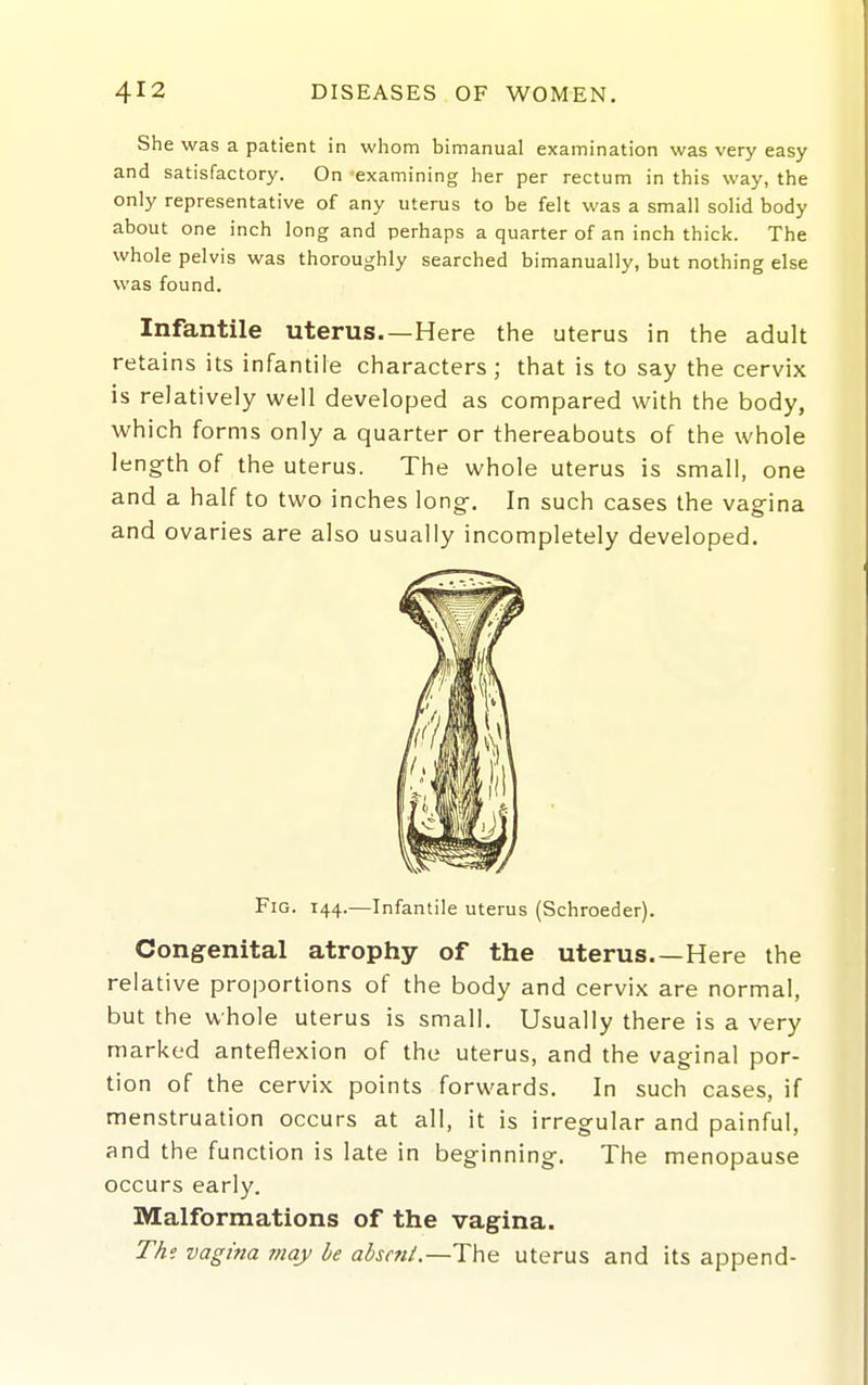 She was a patient in whom bimanual examination was very easy and satisfactory. On examining her per rectum in this way, the only representative of any uterus to be felt was a small solid body about one inch long and perhaps a quarter of an inch thick. The whole pelvis was thoroughly searched bimanually, but nothing else was found. Infantile uterus—Here the uterus in the adult retains its infantile characters; that is to say the cervix is relatively well developed as compared with the body, which forms only a quarter or thereabouts of the whole length of the uterus. The whole uterus is small, one and a half to two inches long-. In such cases the vagina and ovaries are also usually incompletely developed. Fig. 144.—Infantile uterus (Schroeder). Congenital atrophy of the uterus.—Here the relative proportions of the body and cervix are normal, but the whole uterus is small. Usually there is a very marked anteflexion of the uterus, and the vaginal por- tion of the cervix points forwards. In such cases, if menstruation occurs at all, it is irregular and painful, and the function is late in beginning. The menopause occurs early. Malformations of the vagina. The vagina may he absent.—The uterus and its append-