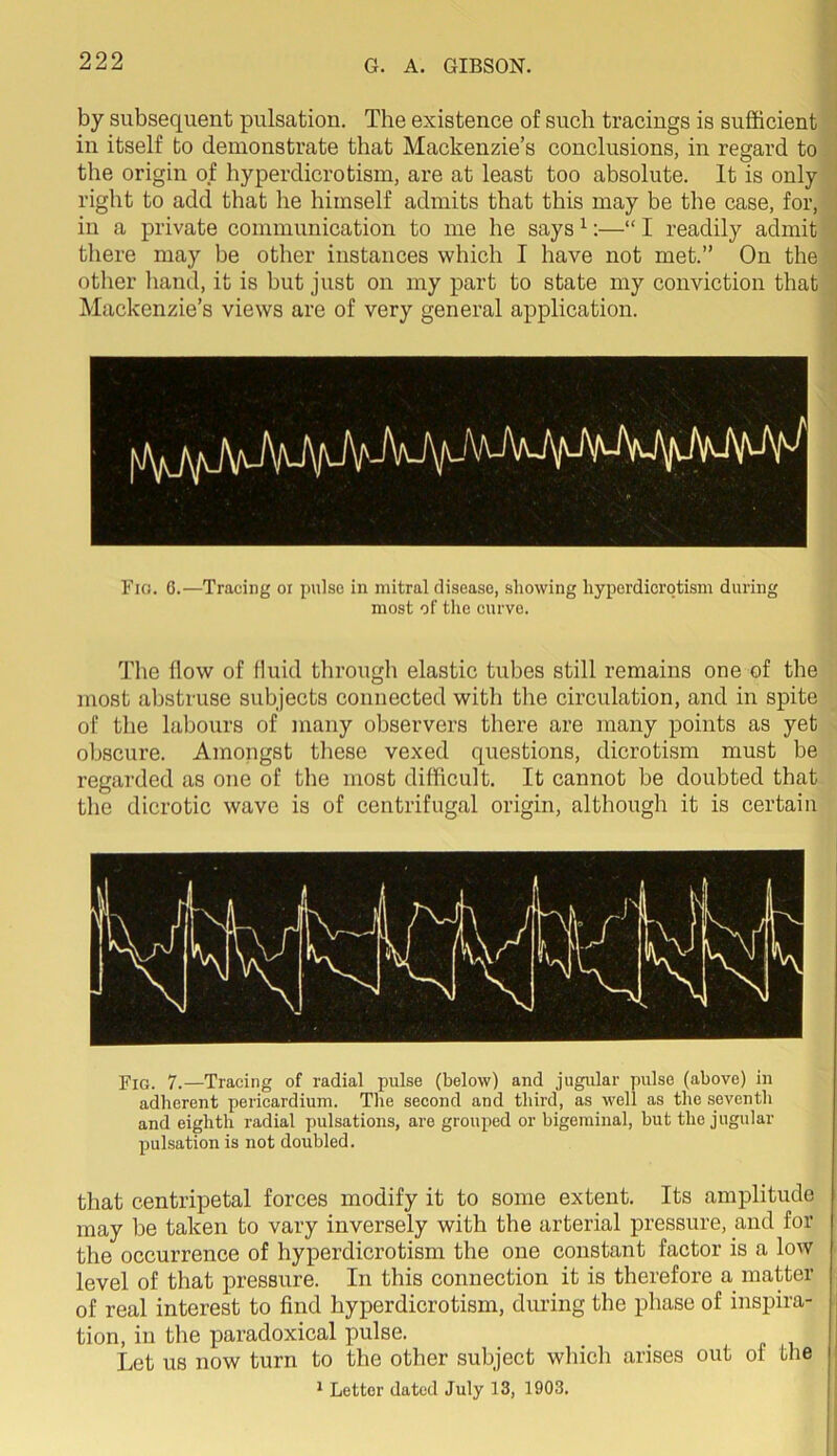 by subsequent pulsation. The existence of such tracings is sufficient in itself to demonstrate that Mackenzie’s conclusions, in regard to the origin of hyperdicrotism, are at least too absolute. It is only right to add that he himself admits that this may be the case, for, in a private communication to me he says ^:—“ I readily admit there may be other instances which I have not met.” On the other liand, it is but just on my part to state my conviction that Mackenzie’s views are of very general application. Fio. 6.—Tracing oi pulse in mitral disease, showing hyperdicrotism during most of the curve. The flow of fluid through elastic tubes still remains one of the most abstruse subjects connected with tlie circulation, and in spite of the labours of many observers there are many points as yet obscure. Amongst tliese vexed questions, dicrotism must be regarded as one of the most difficult. It cannot be doubted that the dicrotic wave is of centrifugal origin, although it is certain Fig. 7.—Tracing of radial pulse (below) and jugular pulse (above) in adherent pericardium. The second and third, as well as the seventh and eighth radial pulsations, are grouped or bigeminal, but the jugular pulsation is not doubled. that centripetal forces modify it to some extent. Its amplitude may be taken to vary inversely with the arterial pressure, and for the occurrence of hyperdicrotism the one constant factor is a low level of that pressure. In this connection it is therefore a matter of real interest to find hyperdicrotism, during the phase of inspira- tion, in the paradoxical pulse. Let us now turn to the other subject which arises out of the * Letter dated July 13, 1903.