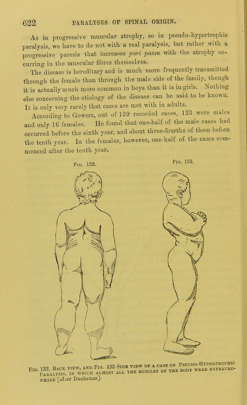 As in progressive muscular atrophy, so in pseudo-hypertrophic paralysis, we have to do not with a real paralysis, but rather with a progressive paresis that increases pari j>assu with the atrophy oc- curring in the muscular fibres themselves. The°disease is hereditary and is much more frequently transmitted through the female than through the male side of the family, though it is actually much more common in boys than it is in girls. Nothing else concerning the etiology of the disease can be said to be known. It is only very rarely that cases are met with in adults. According to Gowers, out of 139 recorded cases, 123 were males and only 16 females. He found that one-half of the male cases had occurred before the sixth year, and about three-fourths of them before the tenth year. In the females, however, one-half of the cases com- menced after the tenth year. Fig. 132. Fig. 133. PHiED [lifter Duchenue].