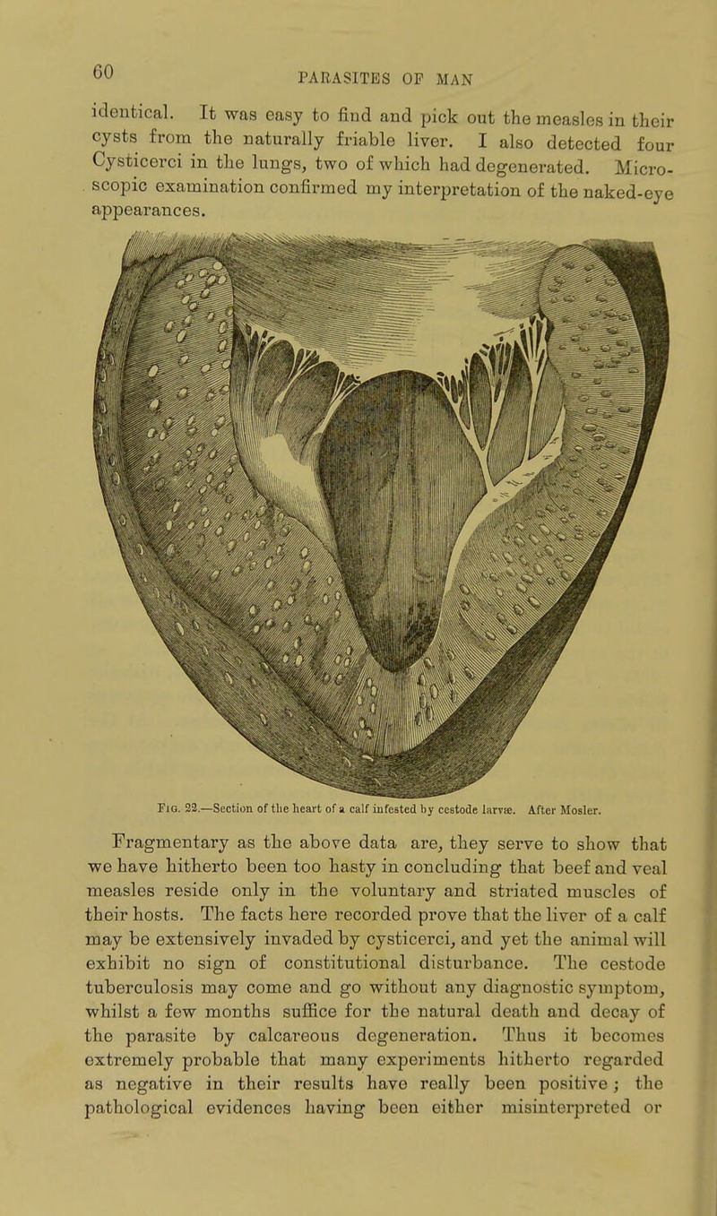 CO PARASITES OF MAN identical. It was easy to find and pick out the measles in their cysts from the naturally friable liver. I also detected four Cysticerci in the lungs, two of which had degenerated. Micro- scopic examination confirmed my interpretation of the naked-eye appearances. Fig. 22.—Section of the heart of a calf infested by cestode larvsc. After Mosler. Fragmentary as the above data are, they serve to show that we have hitherto been too hasty in concluding that beef and veal measles reside only in the voluntary and striated muscles of their hosts. The facts here recorded prove that the liver of a calf may be extensively invaded by cysticerci, and yet the animal will exhibit no sign of constitutional disturbance. The cestode tuberculosis may come and go without any diagnostic symptom, whilst a few months suffice for the natural death and decay of the parasite by calcareous degeneration. Thus it becomes extremely probable that many experiments hitherto regarded as negative in their results have really been positive; the pathological evidences having been either misinterpreted or