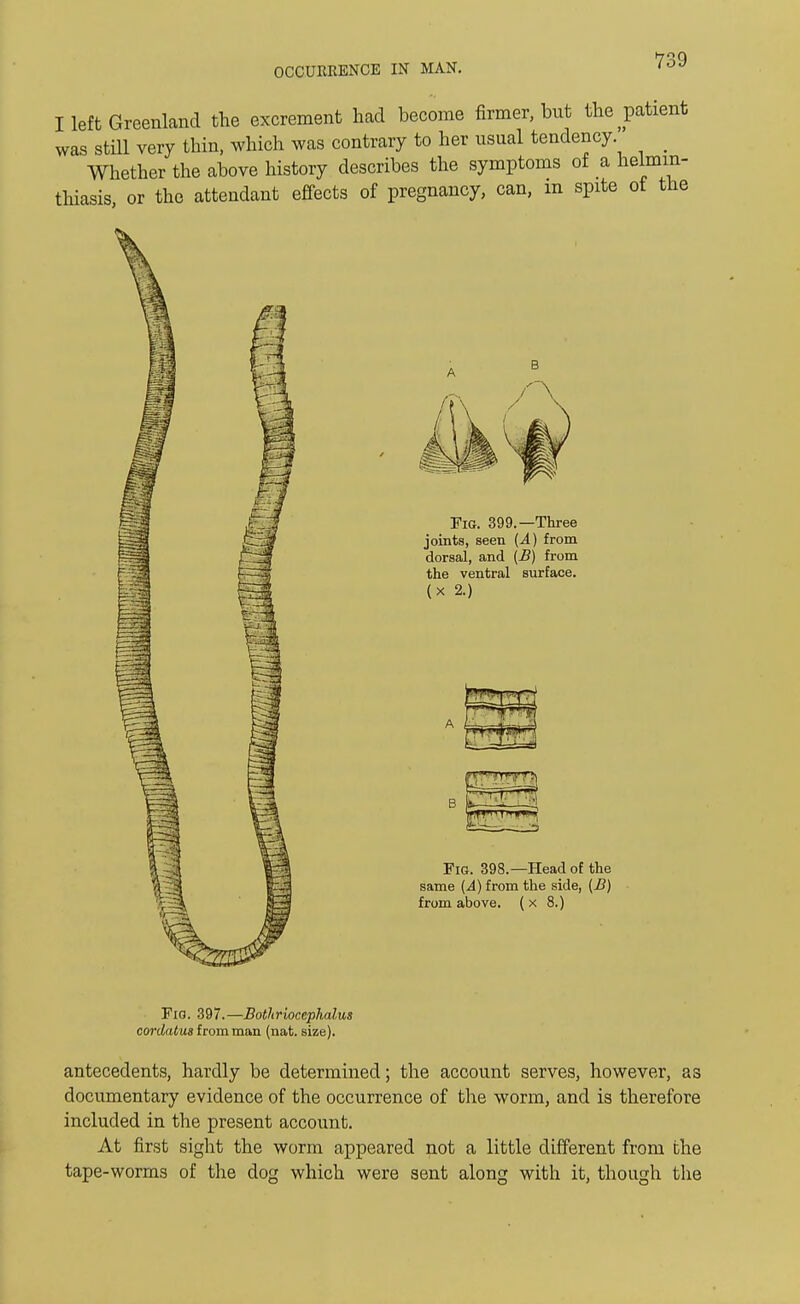 I left Greenland the excrement had become firmer, but the patient was still very thin, which was contrary to her usual tendency _ Whether the above history describes the symptoms of a helmin- thiasis, or the attendant effects of pregnancy, can, m spite ot the Fig. 399.—Three joints, seen (A) from dorsal, and (B) from the ventral surface, (x 2.) Fig. 397.—Bothriocephalus cordatus from man (nat. size). antecedents, hardly be determined; the account serves, however, as documentary evidence of the occurrence of the worm, and is therefore included in the present account. At first sight the worm appeared not a little different from the tape-worms of the dog which were sent along with it, though the