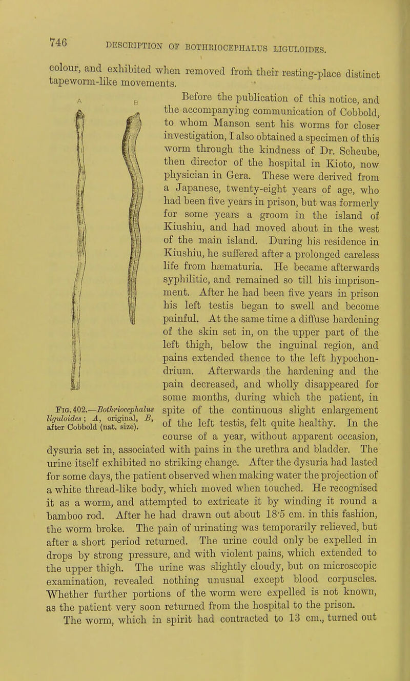colour, and exhibited when removed from their resting-place distinct tapeworm-like movements. Before the publication of this notice, and the accompanying communication of Cobbold, to whom Manson sent his worms for closer investigation, I also obtained a specimen of this worm through the kindness of Dr. Scheube, then director of the hospital in Kioto, now physician in Gera. These were derived from a Japanese, twenty-eight years of age, who had been five years in prison, but was formerly for some years a groom in the island of Kiushiu, and had moved about in the west of the main island. During his residence in Kiushiu, he suffered after a prolonged careless life from hematuria. He became afterwards syphilitic, and remained so till his imprison- ment. After he had been five years in prison his left testis began to swell and become painful. At the same time a diffuse hardening of the skin set in, on the upper part of the left thigh, below the inguinal region, and pains extended thence to the left hypochon- drium. Afterwards the hardening and the pain decreased, and wholly disappeared for some months, during which the patient, in Fig. 402.—BotJirioccphalus spite of the continuous slight enlargement of the left testis, felt quite healthy. In the course of a year, without apparent occasion, dysuria set in, associated with pains in the urethra and bladder. The urine itself exhibited no striking change. After the dysuria had lasted for some days, the patient observed when making water the projection of a white thread-like body, which moved when touched. He recognised it as a worm, and attempted to extricate it by winding it round a bamboo rod. After he had drawn out about 18-5 cm. in this fashion, the worm broke. The pain of urinating was temporarily relieved, but after a short period returned. The urine could only be expelled in drops by strong pressure, and with violent pains, which extended to the upper thigh. The urine was slightly cloudy, but on microscopic examination, revealed nothing unusual except blood corpuscles. Whether further portions of the worm were expelled is not known, as the patient very soon returned from the hospital to the prison. The worm, which in spirit had contracted to 13 cm., turned out liguloides; A, original, B, after Cobbold (nat. size).