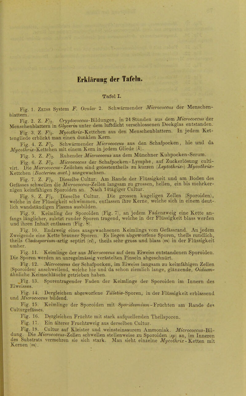 Erklärnug der Tafeln. Tafel I. Fig. 1. Zeiss System F. Ocular 2. Schwärmender Micrococcus der Menschen- blattern. Fiff 2 Z Fl-i. Cryp^ococcMS-Bildungen, in 24 Stunden aus dem Micrococcus der Menschenblattern'in Ghjcerin unter dem luftdicht verschlossenen Deckglas entstanden. Fig. 3. Z. Fl-2. Mycothrix-KeiichQ^ aus den Menschenblattern. In jedem Ket- tengliede erblickt man einen dunklen Kern. Fig. 4. Z. FI-i. Schwärmender Micrococcus &m den Schafpocken, hie und da 3Iycoihrix-&.eitc)\exi mit einem Kern in jedem Gliede [k]. Fig. 5. Z. Fj-i. Ruhender 3Iicrococcits aus dem Münchner Kuhpocken-Serum. Fig. 6. Z. F/2. Micrococcus der Schafpocken - Lymphe, auf Zuckerlösung culti- virt. Die JWjwococcrMs-Zellchen sind grösstentheils zu kurzen [LejHothrix-] Mycoth-ix- Kettchen [Bacterien auct.) ausgewachsen. Fig. 7. Z. 2^/2. Dieselbe Cultur. Am Rande der Flüssigkeit und_ am_ Boden des Gefässes schwellen die Micrococcus-ZeWen langsam zu grossen, hellen, ein bis mehrker- nigen keimfähigen Sporoiden an. Nach 14tägiger Cultur. Fig. 8. Z. Fji. Dieselbe Cultur. Die grossen kugeligen Zellen (Sporoiden), welche in der Flüssigkeit schwimmen, entlassen ihre Kerne, welche sich in einem deut-. lieh wandständigen Plasma ausbilden. Fig. 9. Keimling der Sporoiden (Fig. 7], an jedem Fadenzweig eine Kette an- fangs länglicher, zuletzt runder Sporen tragend, welche in der Flüssigkeit blass werden und ihren Inhalt entlassen (Fig. 8). Fig. 10. Endzweig eines ausgewachsenen Keimlings vom Gefässrand. An jedem Zweigende eine Kette brauner Sporen. Es liegen abgeworfene Sporen, theils rundlich, theils Cladosporium-Bixüg septirt [cl), theils sehr gross und blass {m) in der Flüssigkeit umher. Fig. 11. Keimlinge der aus Micrococcus auf dem Eiweiss entstandenen Sporoiden. Die Sporen werden an unregelmässig verästelten Pinseln abgeschnürt. Fig. 12. Micrococcus der Schaf[)ocken, im Eiweiss langsam zu keimfähigen Zellen (Sporoiden) anschwellend, welche hie und da schon ziemlich lange, glänzende, Oidium- ähnliche Keimschläuche getrieben haben. _Fig. 13. Sporentragender Faden der Keimlinge der Sporoiden im Innern des Eiweisses. Fig. 14. Dergleichen abgeworfene rjWeija-Sporen, in der Flüssigkeit erblassend und 3Iicrococcus bildend. Fig. 15. Keimlinge der Sporoiden mit S-porides^nium-Früchten am Rande des Culturgefässes. Fig. 16. Dergleichen Früchte mit stark aufquellenden Theilsporen. Fig. 17. Ein älterer Fruchtzwei^ aus derselben Cultur. Fig. 18. Cultur auf Kleister und weinsteinsaurem Ammoniak. Micrococcus-Bil- dung. Die Micrococcus-Zellen schwellen stellenweise zu Sporoiden \sp) an, im Inneren des Substrats vermehren sie sich stark. Man sieht einzelne Mycothrix-'Ketten mit Kernen [m).