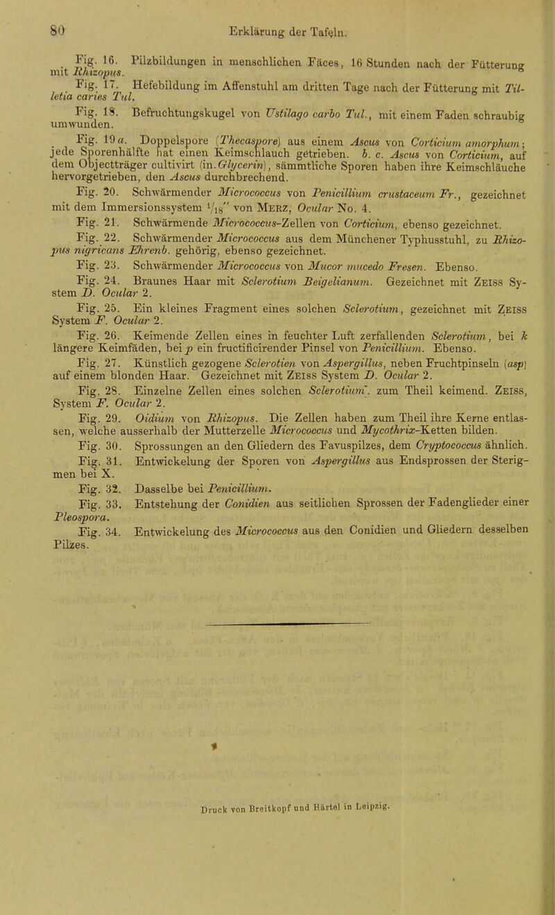 ö: '■ Hefebildung im Affenstuhl am dritten Tage nach der Fütterung mit Tii- . fM- Pilzbildungen in menschlichen Fäces, 16 Stunden nach der Fütterunff mit Jihizopus. ° Fig. 1 letia caries Tul Fig. 19. Befruchtungfskugel von Ustilago carho Tul, mit einem Faden schraubie umwunden. Fig. 19«. Doppelspore [Thecaspore) aus einem Aacm von Corticium amorphuin; jede Sporenhälfte hat einen Keimschlauch getrieben, h. c. Ascus von Corticium, auf dem Objectträger cultivirt (m.Glycerin), sämmtliche Sporen haben ihre Keimschläuche hei-vorgetrieben, den Ascus durchbrechend. Fig. 20. Schwärmender Micrococcus von Femcillium crustaceum Fr., gezeichnet mit dem Immersionssystem Vis von Merz, Oculnr No. 4. Fig. 21. Schwärmende Micrococcus-ZeWen von Cortidum, ebenso gezeichnet. Fig. 22. Schwärmender iJftcrococcMS aus dem Münchener Typhusstuhl, za Rhizo- pus nigriccms Ehrenb. gehörig, ebenso gezeichnet. Fig. 23. Schwärmender Micrococcus von Mucor mucedo Presen. Ebenso. Fig. 24. Braunes Haar mit Sclerotium Beigelianum. Gezeichnet mit Zeiss Sy- stem D. Oeular 2. Fig. 25. Ein kleines Fragment eines solchen Sclerotium, gezeichnet mit Zeiss System F. Oeular 2. Fig. 26. Keimende Zellen eines in feuchter Luft zerfallenden Sclerotium, bei k längere Keimfäden, heip ein fructificirender Pinsel von Penicillium. Ebenso. Fig. 27. Künstlich gezogme Sclerotien yon Aspergillus, neben Fruchtpinseln (asp) auf einem blonden Haar. Gezeichnet mit Zeiss System D. Oeular 2. Fig. 28. Einzelne Zellen eines solchen Sclerotium. zum Theil keimend. Zeiss, System F. Oeular 2. Fig. 29. Oidimn von Rhizopus. Die Zellen haben zum Theil ihre Kerne entlas- sen, welche ausserhalb der Mutterzelle Micr ococcus und Mycothrix-lL&tten bilden. Fig. 30. Sprossungen an den Gliedern des Favuspilzes, dem Cryptococcus ähnlich. Fig. 31. Entwickelung der Sporen von Aspergillus aus Endsprossen der Sterig- men bei X. Fig. 32. Dasselbe bei Penicillium. Fig. 33. Entstehung der Conidien aus seitlichen Sprossen der Fadenglieder einer Pleospora. Fig. 34. Entwickelung des Micrococcus aus den Conidien und Gliedern desselben Pilzes. Druck von Breitkopf und Härtel in Leipzig.