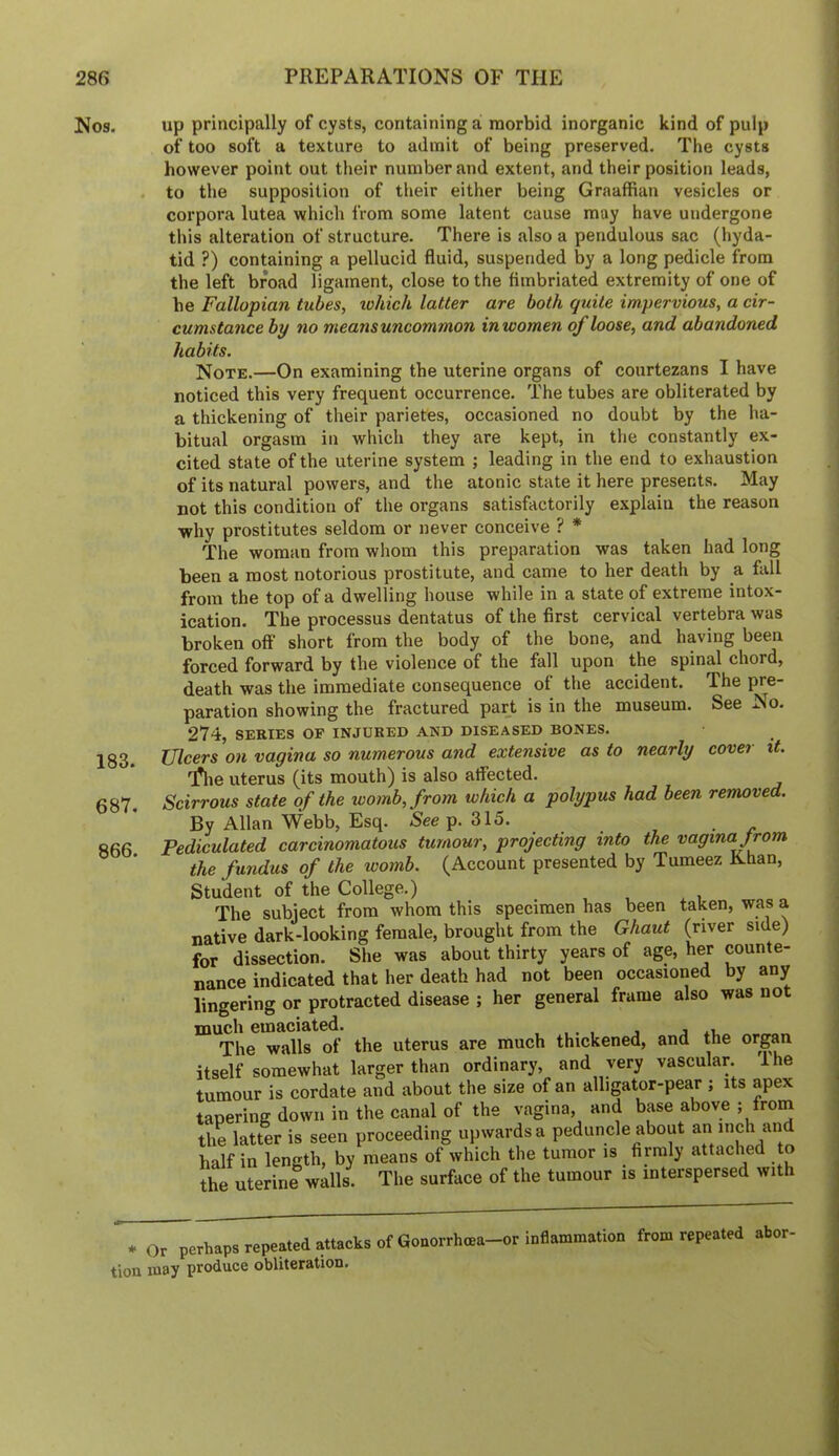 Nos. 183. 687. 866. up principally of cysts, containing a morbid inorganic kind of pulp of too soft a texture to admit of being preserved. The cysts however point out their number and extent, and their position leads, to the supposition of their either being Graaffian vesicles or corpora lutea which from some latent cause may have undergone this alteration of structure. There is also a pendulous sac (hyda- tid ?) containing a pellucid fluid, suspended by a long pedicle from the left broad ligament, close to the fimbriated extremity of one of be Fallopian tubes, lohich latter are both quite impervious, a cir- cumstance by no means uncom mon in women of loose, and abandoned habits. Note.—On examining the uterine organs of courtezans I have noticed this very frequent occurrence. The tubes are obliterated by a thickening of their parietes, occasioned no doubt by the ha- bitual orgasm in which they are kept, in the constantly ex- cited state of the uterine system ; leading in the end to exhaustion of its natural powers, and the atonic state it here presents. May not this condition of the organs satisfactorily explain the reason •why prostitutes seldom or never conceive ? * The woman from whom this preparation was taken had long been a most notorious prostitute, and came to her death by a fall from the top of a dwelling house while in a state of extreme intox- ication. The processus dentatus of the first cervical vertebra was broken off short from the body of the bone, and having been forced forward by the violence of the fall upon the spinal chord, death was the immediate consequence of the accident. The pre- paration showing the fractured part is in the museum. See No. 274, SERIES OP INJURED AND DISEASED BONES. Ulcers on vagina so numerous and extensive as to nearly cover it. 'file uterus (its mouth) is also atfected. Scirrous state of the womb, from which a polypus had been removed. By Allan Webb, Esq. S'eep. 315. _ , • e Pediculated carcinomatous tumour, projecting into the vagina Jrom the fundus of the womb. (Account presented by Tumeez Khan, Student of the College.) . , , . i The subject from whom this specimen has been taken, was a native dark-looking female, brought from the Ghaut (river side) for dissection. She was about thirty years of age, her counte- nance indicated that her death had not been occasioned by any lingering or protracted disease ; her general frame also was not much emaciated. . ,. , i j ii. The walls of the uterus are much thickened, and the organ itself somewhat larger than ordinary, and very vascular. Ihe tumour is cordate and about the size of an alligator-pear ; its apex tapering down in the canal of the vagina, and base above ; from the latter is seen proceeding upwards a peduncle about an inch and half in length, by means of which the tumor is firmly attached o tL uterine walls. The surface of the tumour is interspersed with * Or perhaps repeated attacks of Goaorrhcea-or inflammation from repeated abor tion may produce obliteration.