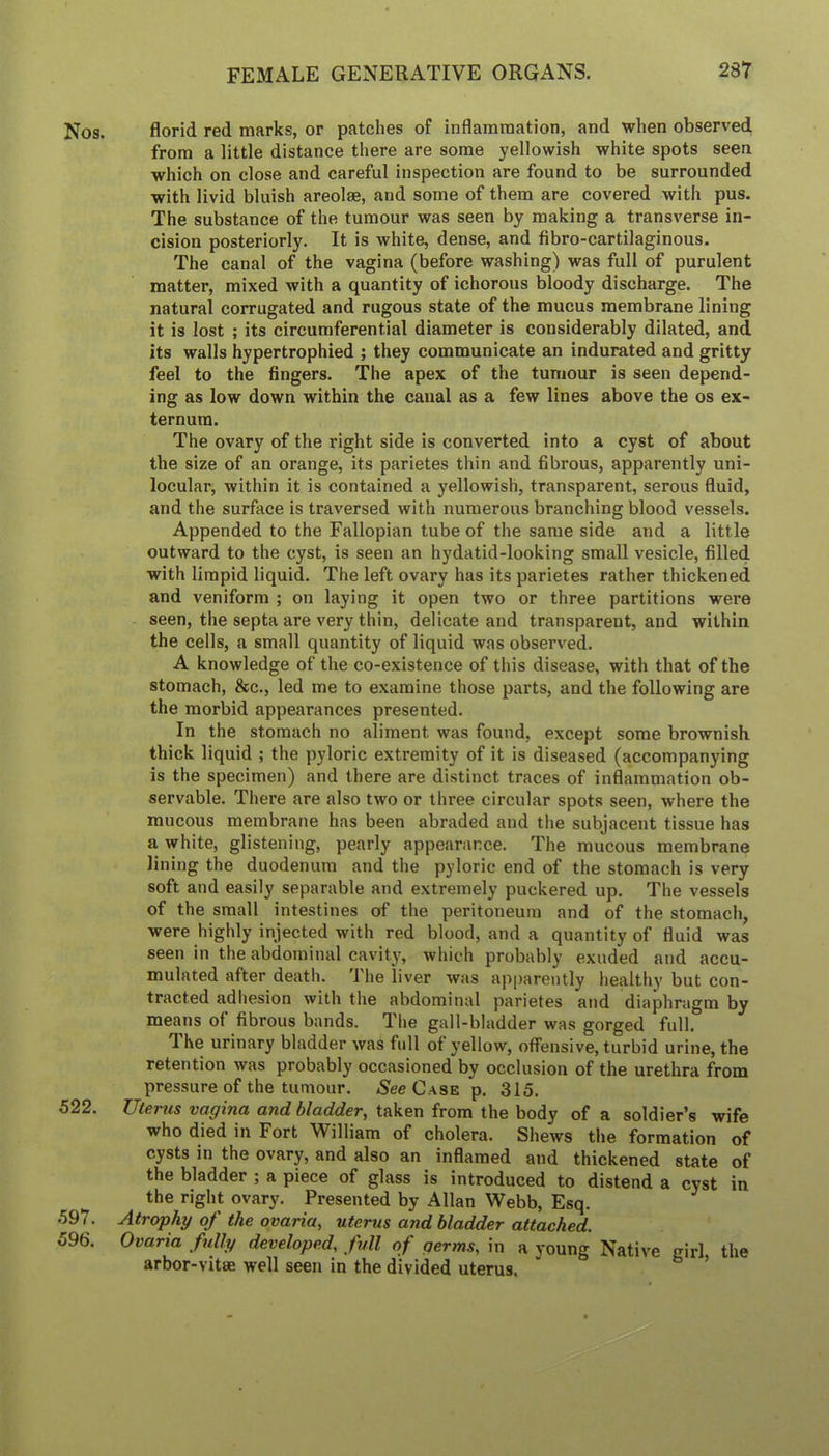 Nos. florid red marks, or patches of inflammation, and when observed from a little distance there are some yellowish white spots seen which on close and careful inspection are found to be surrounded with livid bluish areolae, and some of them are covered with pus. The substance of the tumour was seen by making a transverse in- cision posteriorly. It is white, dense, and fibro-cartilaginous. The canal of the vagina (before washing) was full of purulent matter, mixed with a quantity of ichorous bloody discharge. The natural corrugated and rugous state of the mucus membrane lining it is lost ; its circumferential diameter is considerably dilated, and its walls hypertrophied ; they communicate an indurated and gritty feel to the fingers. The apex of the tumour is seen depend- ing as low down within the canal as a few lines above the os ex- ternum. The ovary of the right side is converted into a cyst of about the size of an orange, its parietes thin and fibrous, apparently uni- locular, within it is contained a yellowish, transparent, serous fluid, and the surface is traversed with numerous branching blood vessels. Appended to the Fallopian tube of the same side and a little outward to the cyst, is seen an hydatid-looking small vesicle, filled with limpid liquid. The left ovary has its parietes rather thickened and veniform ; on laying it open two or three partitions were seen, the septa are very thin, delicate and transparent, and within the cells, a small quantity of liquid was observed. A knowledge of the co-existence of this disease, with that of the stomach, &c., led me to examine those parts, and the following are the morbid appearances presented. In the stomach no aliment was found, except some brownish thick liquid ; the pyloric extremity of it is diseased (accompanying is the specimen) and there are distinct traces of inflammation ob- servable. There are also two or three circular spots seen, where the mucous membrane has been abraded and the subjacent tissue has a white, glistening, pearly appearance. The mucous membrane lining the duodenum and the pyloric end of the stomach is very soft and easily separable and extremely puckered up. The vessels of the small intestines of the peritoneum and of the stomach, were highly injected with red blood, and a quantity of fluid was seen in the abdominal cavity, which probably exuded and accu- mulated after death. The liver was apparently healthy but con- tracted adhesion with the abdominal parietes and diaphragm by means of fibrous bands. The gall-bladder was gorged full. The urinary bladder was full of yellow, offensive, turbid urine, the retention was probably occasioned by occlusion of the urethra from pressure of the tumour. Nee Case p. 315. 522. Uterus vagina and bladder, taken from the body of a soldier’s wife who died in Fort William of cholera. Shews the formation of cysts in the ovary, and also an inflamed and thickened state of the bladder ; a piece of glass is introduced to distend a cyst in the right ovary. Presented by Allan Webb, Esq. 597. Atrophy of the ovaria, uterus and bladder attached. 596. Ovaria fully developed, full of germs, in a young Native girl the arbor-vitae well seen in the divided uterus. ’
