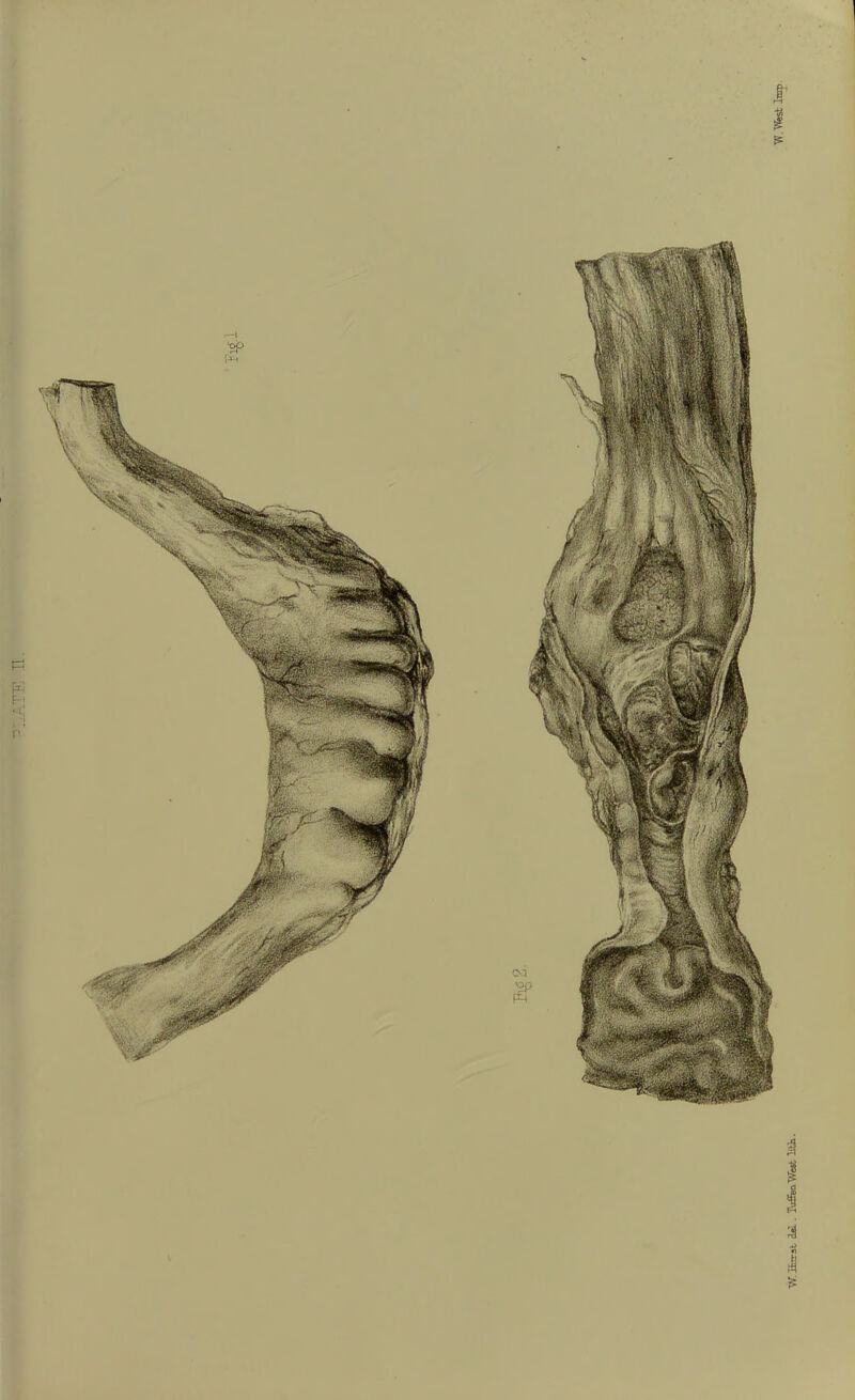 W. Irsrat del . TuffeaWest litin.
