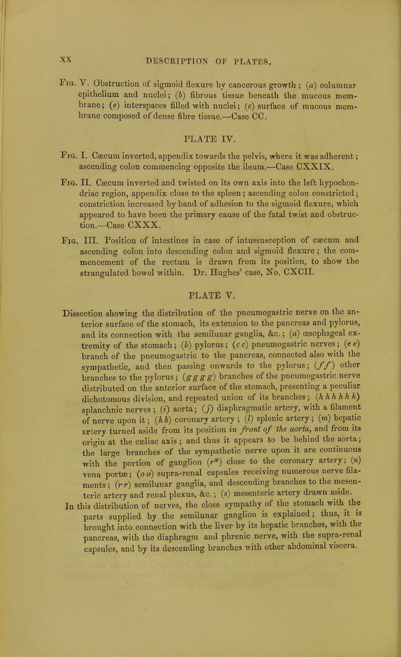 1' ig. V. Obstruction of sigmoid flexure by cancerous growth ; (a) columnar epithelium and nuclei; (b) fibrous tissue beneath the mucous mem- brane; (e) interspaces filled with nuclei; (c) surface of mucous mem- brane composed of dense fibre tissue.—Case CC. PLATE IV. Fig. I. Caecum inverted, appendix towards the pelvis, where it was adherent; ascending colon commencing opposite the ileum.—Case CXXIX. Fig. II. Caecum inverted and twisted on its own axis into the left hypochon- driac region, appendix close to the spleen; ascending colon constricted; constriction increased by band of adhesion to the sigmoid flexure, which appeared to have been the primary cause of the fatal twist and obstruc- tion.—Case CXXX. Fig. III. Position of intestines in case of intussusception of caecum and ascending colon into descending colon and sigmoid flexure; the com- mencement of the rectum is drawn from its position, to show the strangulated bowel within. Dr. Hughes’ case, No. CXCII. PLATE V. Dissection showing the distribution of the pneumogastric nerve on the an- terior surface of the stomach, its extension to the pancreas and pylorus, and its connection with the semilunar ganglia, &c.; (a) oesophageal ex- tremity of the stomach ; (5) pylorus ; (c c) pneumogastric nerves ; (e e) branch of the pneumogastric to the pancreas, connected also with the sympathetic, and then passing onwards to the pylorus; (//) other branches to the pylorus ; (gggg) branches of the pneumogastric nerve distributed on the anterior surface of the stomach, presenting a peculiar dichotomous division, and repeated union of its branches ; (hhh hh h) splanchnic nerves ; (?) aorta; (j) diaphragmatic artery, with a filament of nerve upon it; (A k) coronary artery ; (l) splenic artery; (m) hepatic artery turned aside from its position in front of the aorta, and from its origin at the cseliac axis ; and thus it appears to be behind the aorta; the° large branches of the sympathetic nerve upon it are continuous with the portion of ganglion (r*) close to the coronary artery; (n) vena portae; (o o) supra-renal capsules receiving numerous nerve fila- ments ; (rr) semilunar ganglia, and descending branches to the mesen- teric artery and renal plexus, &c.; (s) mesenteric artery diawn aside. In this distribution of nerves, the close sympathy of the stomach with the parts supplied by the semilunar ganglion is explained; thus, it is brought into connection with the liver by its hepatic branches, with the pancreas, with the diaphragm and phrenic nerve, with the supra-ienal capsules, and by its descending branches with other abdominal viscei a.