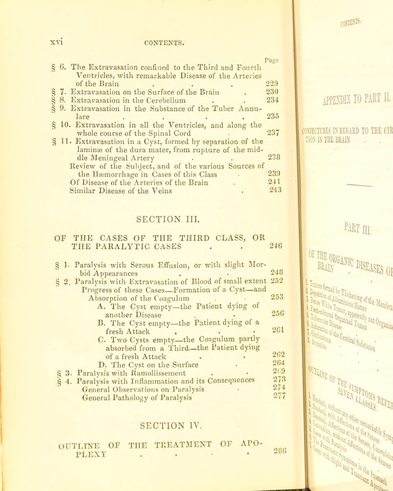 C/75 § 7. § 8. S 9. 6. The Extravasation confined to the Third and Fourth Ventricles, with remarkable Disease of the Arteries of the Brain Extravasation on the Surface of the Brain Extravasation in the Cerebellum Extravasation in the Substance of the Tuber Annu- lare . . . . 10. Extravasation in all the Ventricles, and along the whole course of the Spinal Cord 11. Extravasation in a Cyst, formed by separation of the laminae of the dura mater, from rupture of the mid- dle Meningeal Artery Review of the Subject, and of the various Sources of the Haemorrhage in Cases of this Class Of Disease of the Arteries of the Brain Similar Disease of the Veins Page 22!) 230 234 235 237 238 230 241 243 SECTION III. OF THE CASES OF THE THIRD CLASS, OR THE PARALYTIC CASES . . 246 § 1- Paralysis with Serous Effusion, or with slight Mor- bid Appearances § 2. Paralysis with Extravasation of Blood of small extent Progress of these Cases—Formation of a Cyst—and Absorption of the Coagulum A. The Cyst empty—the Patient dying of another Disease B. The Cyst empty—the Patient dying of a fresh Attack C. Two Cysts empty—the Coagulum partly absorbed from a Third—the Patient dying of a fresh Attack D. The Cyst on the Surface § 3. Paralysis with Ramollissement § 4. Paralysis with Inllammation and its Consequences General Observations on Paralysis General Pathology of Paralysis 248 252 253 256 261 262 264 2<.9 273 274 277 SECTION IV. OUTLINE OF THE TREAT.MENT OF APO- PLEXY . . • •