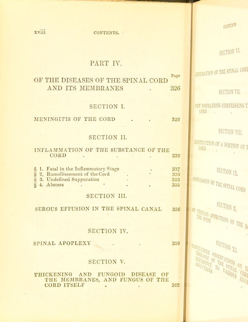 PART IV. OF THE DISEASES OF THE SPINAL CORD AND ITS MEMBRANES SECTION I. MENINGITIS OF THE CORD SECTION II. INFLAMMATION OF THE SUBSTANCE OF THE CORD § 1. Fatal in the Inflammatory Stage § 2. Ramollissement of the Cord § 3. Undefined Suppuration § 4. Abscess SECTION III. SEROUS EFFUSION IN THE SPINAL CANAL SECTION IV. SPINAL APOPLEXY SECTION V. THICKENING AND FUNGOID DISEASE OF THE BIEiMBRANES, AND FUNGUS OF THE CORD ITSELF