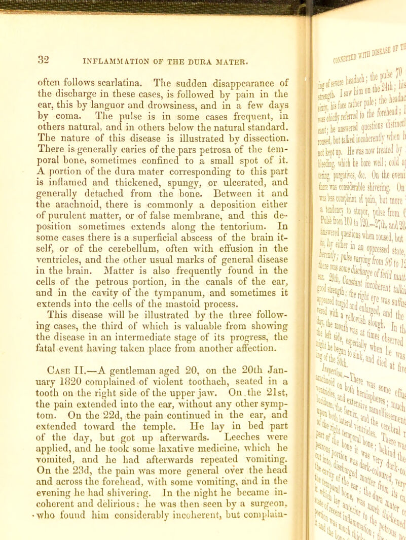 often follows scarlatina. The sudden disappearance of the discharge in these cases, is followed by pain in the ear, this by languor and drowsiness, and in a few days by coma. The pulse is in some cases frequent, in others natural, and in others below the natural standard. The nature of this disease is illustrated by dissection. There is generally caries of the pars petrosa of the tem- poral bone, sometimes confined to a small spot of it. A portion of the dura mater corresponding to this part is inflamed and thickened, spungy, or ulcerated, and generally detached from the bone. Between it and the arachnoid, there is commonly a deposition either of purulent matter, or of false membrane, and this de- position sometimes extends along the tentorium. In some cases there is a superficial abscess of the brain it- self, or of the cerebellum, often with effusion in the ventricles, and the other usual marks of general disease in the brain. IMatter is also frequently found in the cells of the petrous portion, in the canals of the ear, and in the cavity of the tympanum, and sometimes it extends into the cells of the mastoid process. This disease will be illustrated by the three follow- ing cases, the third of which is valuable from showing the disease in an intermediate stage of its progress, the fatal event having taken place from another affection. Case II.—A gentleman aged 20, on the 20th Jan- uary 1820 complained of violent toothach, seated in a tooth on the right side of the upper jaw. On . the 21st, the pain extended into the ear, without any other symp- tom. On the 22d, the pain continued in the ear, and extended toward the temple. lie lay in bed part of the day, but got up afterwards. Leeches were applied, and he took some laxative medicine, which he vomited, and he had afterwards repeated vomiting. On the 23d, the pain was more general over the head and across the forehead, with some vomiting, and in the evening he had shivei'ing. In the night he became in- coherent and delirious: he was then seen by a surgeon, who found him considerably incoherent, but complain- 11. tosnfcr 1*1 usciiieDnw*™ ‘ Qit; he ansifered qucslions disfinc I rod, hit talked incoliereullF'riienli Mlkeptup. He re now treated hy HeAf irhich be bore well; cold ii] t'linj, piirjatives, kt. Oa tbe even! I'antn/ioM >h\ »htrn*in/f Ibn |/m^auic9j tu, ou uiv tibiu ibaemjcoaArable sbiveriDg. Un i^lescraplmtofpm, ktmore a teiJeiiq to stapoi, raise (tom ( roused, but a \mm to HQjoT, iroia ( Mfe®l«)tolt-2(tli,!ffid211 Mdjucsranstvbeu roused, but Jjfulsevarniifffrojjq/Ji j( !■ 4 ■ ''ueii U' wi Hisciar