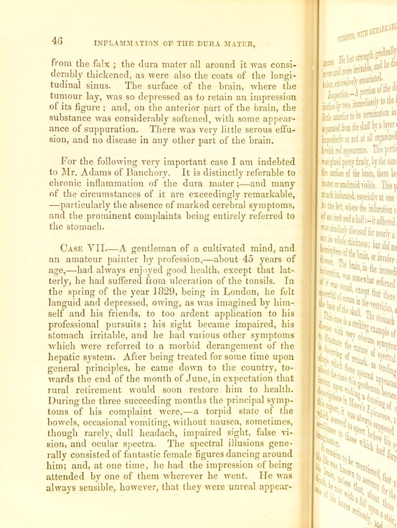 from the falx ; the dura mater all around it was consi- derably thickened, as were also the coats of the longi- tudinal sinus. The surface of the brain, lyhere the tumour lay, was so depressed as to retain an impression of its figure ; and, on the anterior part of the brain, the substance was considerably softened, ivith some appear- ance of suppuration. There ivas very little serous effu- sion, and no disease in any other part of the brain. For the following very important case I am indebted to Jlr. Adams of Banchory. It is distinctly referable to chronic inflammation of the dura mater ;—and many of the circumstances of it are exceedingly remarkable, —particularly the absence of marked cerebral symptoms, and the prominent complaints being entirely referred to the stomach. Case VII—A gentleman of a cultivated mind, and an amateur painter by profession,—about 45 years of age,—had always enj >yed good health, except that lat- terly, he had suffered from ulceration of the tonsils. In the spring of the year 1829, being in London, he felt languid and depressed, oiving, as was imagined by him- self and his friends, to too ardent application to his professional pursuits ; his sight became impaired, his stomach irritable, and he had various other s^miptoms Avhich ivere referred to a morbid derangement of the hepatic system. After being treated for some time upon general principles, he came down to the country, to- wards the end of the month of June, in expectation that rural retirement would soon restore him to health. During the three succeeding months the principal symp- toms of his complaint ■were,—a torpid state of the bowels, occasional vomiting, without nausea, sometimes, though rarely, dull headach, impaired sight, false vi- sion, and ocular spectra. The spectral illusions gene- rally consisted of fantastic female figures dancing around him; and, at one time, he Iiad the impression of being attended by one of them wherever he went. He was always sensible, however, that they were unreal appear- rcsoMf) (rraJaally iiiifaBleriorloilstemiiiatioii in jfptedlronitliesWltjalaTen kperfeciiv or not at all orpnized loimli red appearance. Tliis porli( raey pretiy Wy,lijilie sani fc smace of tte kin, llicre be Eater or aiackoii liable. 'Iliisp hike left, itberetbe infiutatione da half ;-it adhered I,,; ^^kniacl, di: 4 iin? “'^rtL^Poseti .h It ate 'Ss'iL.N,' },y. %fih