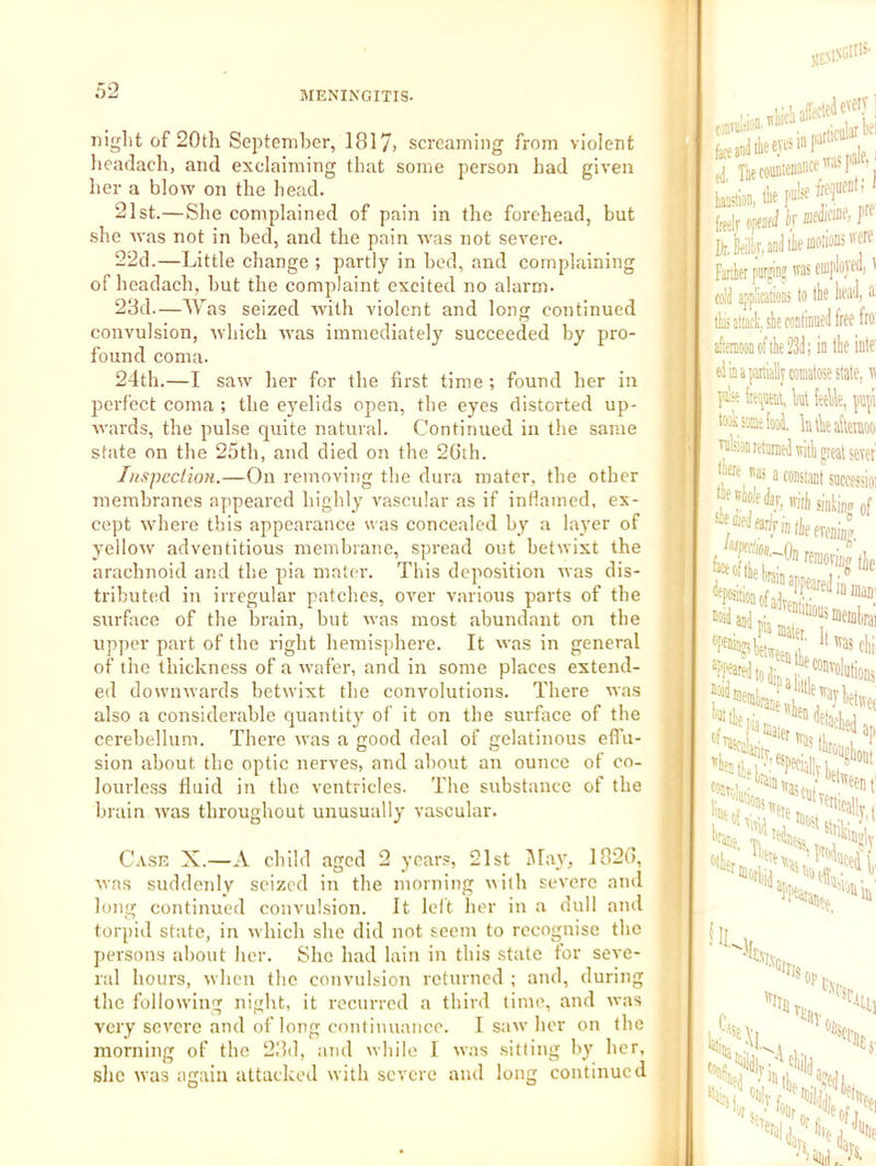 night of 20th September, 1817> screaming from violent headach, and exclaiming that some person had given her a blow on the head. 21st.—She complained of pain in the forehead, but she was not in bed, and the pain w'as not severe. 22d.—Little change ; partly in bed, and complaining of headach, but the complaint excited no alarm. 23d.—Was seized -with violent and long continued convulsion, which was immediately succeeded by pro- found coma. 24th.—I saw her for the first time; found her in perfect coma ; the eyelids open, the eyes distorted up- wards, the pulse cjuite natural. Continued in the same state on the 25th, and died on the 2(ith. luspeclioH.—On removing the dura mater, the other membranes appeared highly vascular as if intiamed, ex- cept where this appearance n as concealed by a layer of yellow adventitious membrane, spread out betwixt the arachnoid and the pia mater. This deposition was dis- tributed in irregular patches, over various parts of the surface of the brain, but was most abundant on the upper part of the right hemisphere. It was in general of the thickness of a wafer, and in some places extend- ed downwards betwixt the convolutions. There was also a considerable quantity of it on the surface of the cerehellum. There was a good deal of gelatinous eflTu- sion about the optic nerves, and about an ounce of co- lourless fluid in the ventricles. The substance of the brain was throughout unusually vascular. Case X.—A child aged 2 years, 21st May, 1820, was suddenly seized in the morning ^^ilh severe and long continued convulsion. It left her in a dull and torpid state, in which she did not seem to recognise the persons about her. She had lain in this state for seve- ral hours, when the convulsion returned ; and, during the following night, it recurred a third time, and was very severe and of long continuance. I s:iw her on the morning of the 23d, and while 1 was sitting Iry her, she was again attacked with severe and long continued feanJllieevcsinP^% Lion, tk pi^e J frttlr optnfil k P Dr,»j,aaJilemoW''frc Fankr piirjinj w ciiiploiWj' coll applications to the lioaJ, ii! tE attack, she coaliniiel free fro: afieniooDofthePSJ; in the inte: dii a partially comatose state, w pise iitipaeiil, kt feelle, ptipi took soBt fool, lutkafteinoo' ruhionretameltviih great setef const,mt successioi •here tras a sinking of e ereninrr, f/y^-OnrernoriAie coil :?'“'P'5-na,err^“'Wap i, ■‘'tally,, ‘Ice in !il •ris kill op h\ps ihi, kiv 'Jt -Ofl