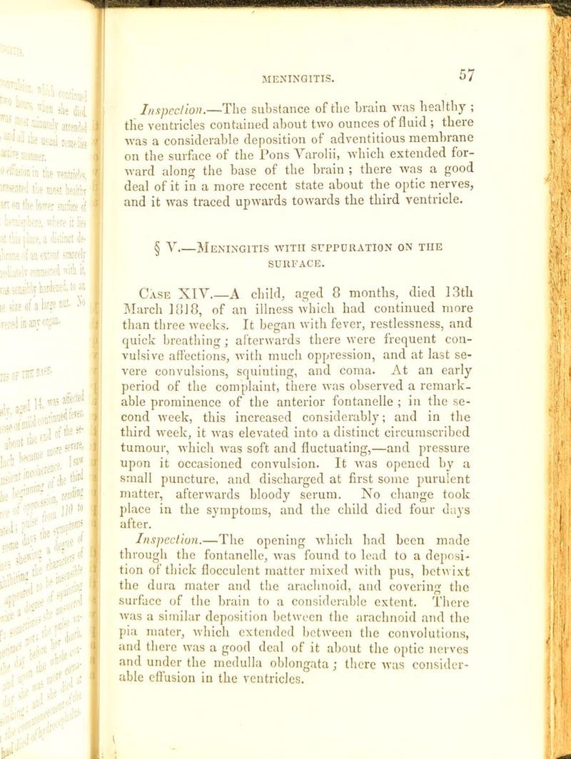 Inspcclion.—Tlie substance of tlie brain was healthy ; the ventricles contained about two ounces of fluid ; there was a considerable deposition of adventitious membrane on the surface of the Pons Varolii, Avhich extended for- ward along the base of the brain ; there was a good deal of it in a more recent state about the optic nerves, and it was traced upwards towards the third ventricle. § Y Meningitis with supporation on the SURFACE. Case XIY.—A child, aged 8 months, died 13th March 1810, of an illness which had continued more than three weeks. It began with fever, restlessness, and quick breathing; afterwards there were frequent con- vulsive affections, with much oppression, and at last se- vere convulsions, squinting, and coma. At an early period of the complaint, there was observed a remark- able prominence of the anterior fontanelle ; in the se- cond week, this increased considerably; and in the third week, it was elevated into a distinct circumscribed tumour, which was soft and fluctuating,—and pressure upon it occasioned convulsion. It ivas opened by a small puncture, and discharged at first some purulent matter, afterwards bloody serum. No change took place in the symptoms, and the child died four days after. Inspection.—The opening which liad been made through the fontanelle, was found to lead to a dej)osi- tion of thick flocculent matter mixed with pus, betwixt tlie dura mater and the arachnoid, and covering the surface of the lirain to a considerable extent. There was a similar deposition between the arachnoid and the pia mater, which extended between the convolutions, and there was a good deal of it about tlie optic nerves and under the medulla oblongata; there was consider- able effusion in the ventricles. t