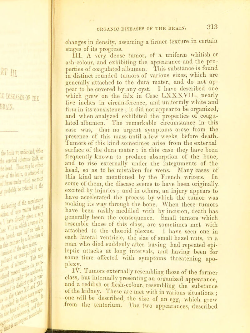 'U sr III OF THE brain. liie l.’aiD K imfeliiil [iie oerelrol fcteE“ i naler 'ifeli ;il fiirTi [ r pro! fbe reieirtl to tl>a >* :■ hi changes in density, assuming a firmer texture in certain stages of its progress. III. A very dense tumor, of a uniform whitish or ash colour, and exhibiting the appearance and the pro- perties of coagulated albumen. This substance is found in distinct rounded tumors of various sizes, which are generally attached to the dura mater, and do not ap- pear to he covered by any cyst. I have described one which grew on the falx in Case LXXXVII., nearly five inches in circumference, and uniformly white and firm in its consistence ; it did not appear to be organized, and when analyzed exhibited the properties of coagu- lated albumen. The remaikable circumstance in this case Mas, that no urgent symptoms arose from the presence of this mass until a few weeks before death. Tumors of this kind sometimes arise from the external surface of the dura mater ; in this case they have been frequently known to produce absorption of the bone, and to rise externally under the integuments of the head, so as to be mistaken for wens. Many cases of this kind are mentioned by the French ivriters. In some of them, the disease seems to have been originally, excited by injuries ; and in others, an injury appears to have accelerated the process by which the tumor was making its ivay through the bone. When these tumors have been rashly meddled ivith by incision, death has generally been the consequence, ymall tumors which resemble those of this class, are sometimes met with attached to the choroid plexus. I have seen one in each lateral ventricle, the size of small hazel nuts, in a nian ivho died suddenly after having had repeated epi- leptic attacks at long intervals, and having been for some time affected with symptoms threatening apo- plexy. IV. Tumors externally resembling those of the former class, but internally ])resenting an organized appearance, and a reddish or flesh-colour, resembling the substance of the kidney. Ihese are met ivith in various situations ; one will be described, the size of an egg, which greiv from the tentorium. Ihc two appearances, described