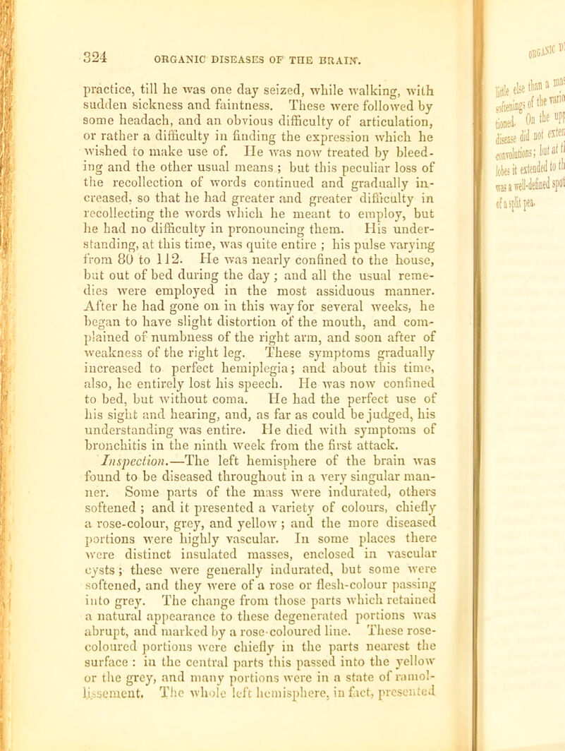 practice, till he was one day seized, while walking, with sudden sickness and faintness. These were followed by some headach, and an obvious difficulty of articulation, or rather a difficulty in finding the expression which he wished to make use of. lie was now treated by bleed- ing and the other usual means ; but this peculiar loss of the recollection of words continued and gradually in- creased, so that he had greater and greater difiiculty in recollecting the words which he meant to employ, but he had no difficulty in pronouncing them. His under- standing, at this time, w’as quite entire ; his pulse varying from 80 to 112. He was nearly confined to the house, but out of bed during the day; and all the usual reme- dies Avere employed in the most assiduous manner. After he had gone on in this Avayfor several weeks, he began to have slight distortion of the mouth, aud com- plained of numbness of the right arm, and soon after of weakness of the right leg. These symptoms gradually increased to jierfect hemiplegia; and about this time, also, he entirely lost his speech. He Avas noAv confined to bed, but Avithout coma. He had the perfect use of his sight and hearing, and, as far as could be judged, his understanding AA'as entire. He died Avith symptoms of bronchitis in the ninth Aveek from the first attack. Inspection.—The left hemisphere of the brain Avas found to be diseased throughout in a A'ery singular man- ner. Some parts of the mass Avere indurated, othem softened ; and it presented a variety of colours, chiefly a rose-colour, grey, and yelloAV ; and the more diseased portions were highly vascular. In some places there Avere distinct insulated masses, enclosed in Avascular cysts ; these AA-ere generally indurated, but some Avere softened, and they Avere of a rose or flesh-colour passing into grey. The change from those parts Avhich retained a natural appearance to these degenerated portions Avas abrupt, and marked by a rose-coloured line. These rose- coloured portions Avere chiefly in the parts neai'est the surface : in the central parts this passed into the yellow or the grey, and many portions Averc in a state of raiuol- lisscmeiit. The Avhole left hemisphere, in f.ict, presented