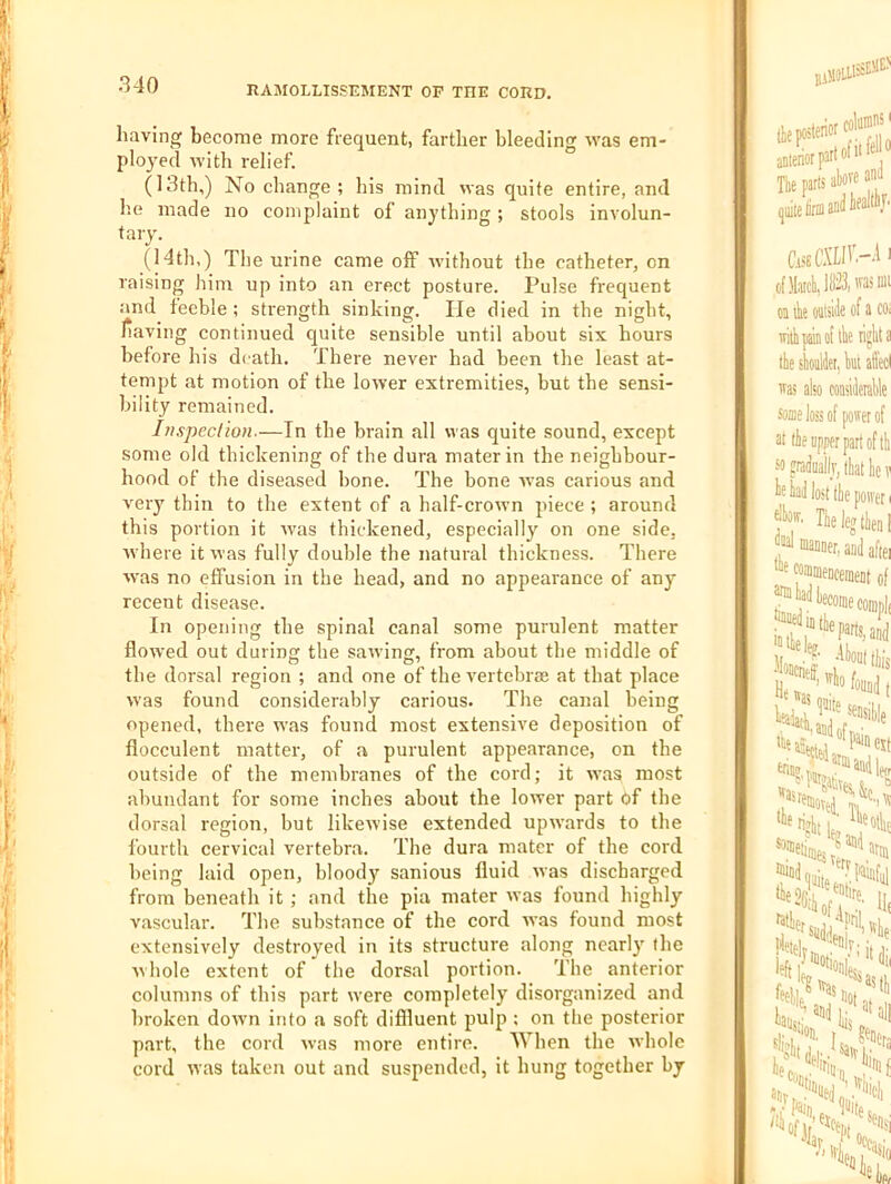 having become more frequent, farther bleeding was em- ployed with relief. (13th,) No change; his mind was quite entire, and lie made no complaint of anything ; stools involun- tary. (I4th,) The urine came off without the catheter, on raising him up into an erect posture. Pulse frequent and feeble ; strength sinking. lie died in the night, liaving continued quite sensible until about six hours before his death. There never had been the least at- tempt at motion of the lower extremities, but the sensi- bility remained. 111 sped ion.—In the brain all was quite sound, except some old thickening of the dura mater in the neighbour- hood of the diseased bone. The bone was carious and very thin to the extent of a half-crown piece ; around this portion it was thickened, especially on one side, where it was fully double the natural thickness. There was no effusion in the head, and no appearance of any recent disease. In opening the spinal canal some purulent matter flowed out durin the sawinsr, from about the middle of the dorsal region ; and one of the vertebrae at that place was found considerably carious. The canal being opened, there was found most extensive deposition of flocculent matter, of a purulent appearance, on the outside of the membranes of the cord; it was most abundant for some inches about the lower part df the dorsal region, but likewise extended upwards to the fourth cervical vertebra. The dura mater of the cord being laid open, bloody sanious fluid was discharged from beneath it ; and the pia mater was found highly vascular. The substance of the cord was found most extensively destroyed in its structure along nearly the whole extent of the dorsal portion. The anterior columns of this part were completely disorganized and broken dowm into a soft diffluent pulp ; on the posterior part, the cord was more entire. AVhen the whole cord was taken out and suspended, it hung together by