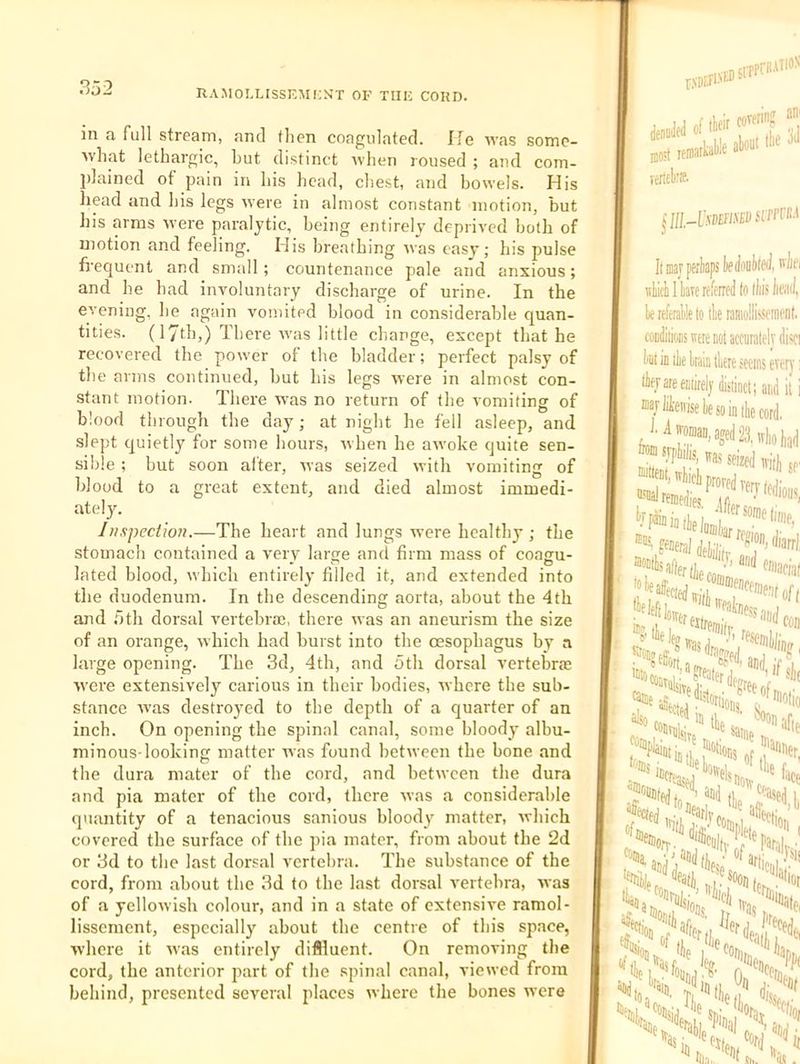 in a full stream, and then coagulated. Ife was some- Avliat lethargic, hut distinct when roused ; and com- plained of pain in his head, chest, and bowels. His head and his legs were in almost constant motion, but his arms were paralytic, being entirely deprived both of U)otion and feeling. His breathing was easy; his pulse frequent and small; countenance pale and anxious; and he had involuntary discharge of urine. In the evening, he again vomited blood in considerable quan- tities. (17th,) There was little charge, except that he recovered the power of the bladder; perfect palsy of the arms continued, but his legs were in almost con- stant motion. There was no return of the vomiting of blood through the day; at night he fell asleep, and slept quietly for some hours, when he awoke quite sen- sible ; but soon alter, was seized with vomiting of blood to a great extent, and died almost immedi- ate!3^ Inspection.—The heart and lungs were healthy ; the stomach contained a very large and firm mass of coagu- lated blood, which entirely filled it, and extended into the duodenum. In the descending aorta, about the 4th and f)th dorsal vertebrae, there was an aneurism the size of an orange, which had burst into the oesophagus by a large opening. The 3d, 4th, and 5th dorsal vertebras were extensively carious in their bodies, where the sub- stance was destroyed to the depth of a quarter of an inch. On opening the spinal canal, some bloody albu- minous-looking matter was found between the bone and the dura mater of the cord, and between the dura and pia mater of the cord, there was a considerable quantity of a tenacious sanious blood}' matter, which covered the surface of the pia mater, from about the 2d or 3d to the last dorsal vertebra. The substance of the cord, from about the 3d to the last dorsal vertebra, was of a yellowish colour, and in a state of extensive ramol- lisscment, especially about the centre of this space, where it Avas entirely diflluent. On removing the cord, the anterior part of the spinal canal, vicAved from behind, presented several places where the bones were si'ppri! most remarkal'le abou verltbrff. It mat pfi'taps beiloiibteti. I'in wbicb I baTC referred to ihh littiii, be referable to lie raniollisseiiient. (oodiiioiis rvere not accurately disci but in lie brain tlere seems ever)'; %areeniirelj distinct; and it i aiajliieivise be so in tie cord. UTOmaD,aged2affboh,id was seized ii'iil, in/ i D!J, Vd, and Skill 1**“ ''™e’itof( ® and fon , tarne^^f'e '®s far snb' ^®dtlio ■' arii„ itrh'ii.^^ddea,], ^^'eson„,®’ilatioi 'it “C'*- oN, (a