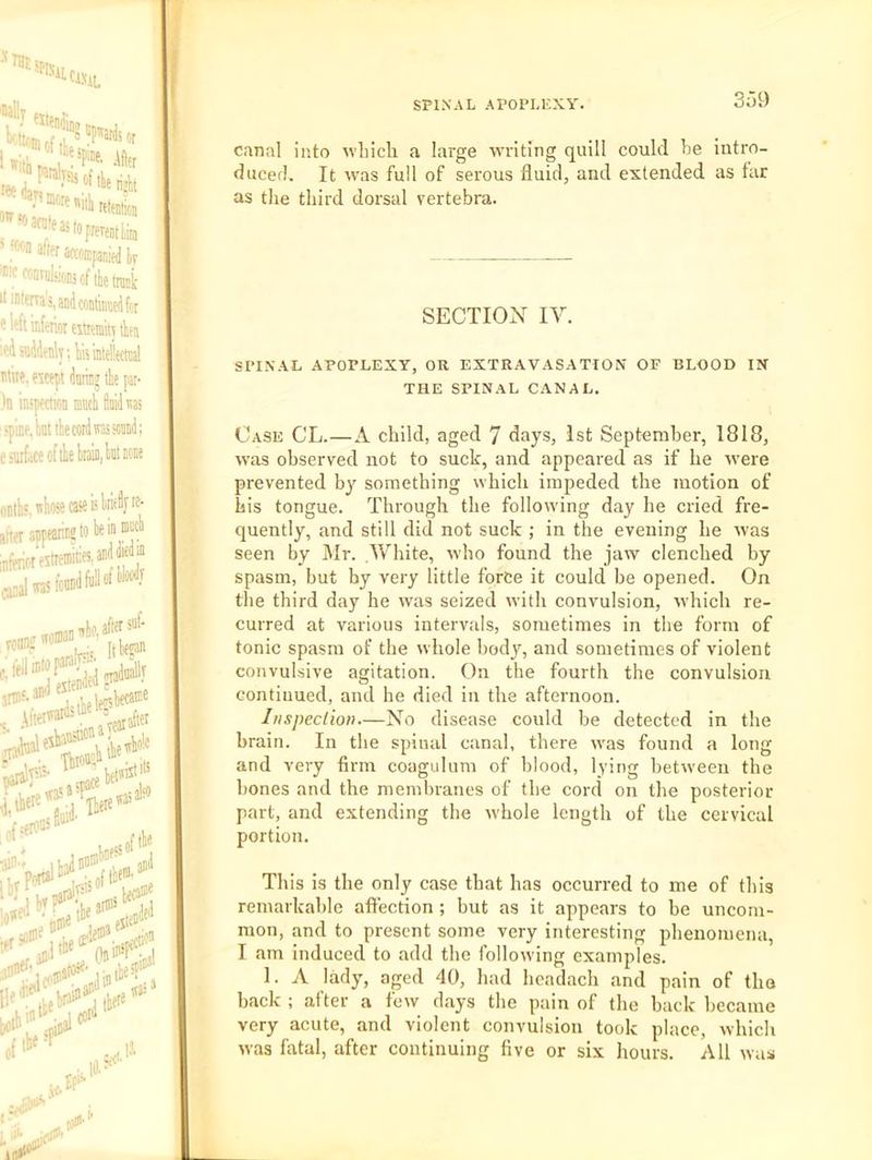' .'^'” saoffifariid Iv ''''’onviiliionsofthetrack It intfrTas,aDdcon&iidt(t «Wt inferiot «timiu iktn '.edsiidddy.liisinteliectiial wii?. eicept daring the par- )n inspection mnch fiuidwi ! I csnrfaceoftliehiaiii.lntiiMe onih'. whose case is hritflyK- ariet anpeannsto beinmch ;niWiwestiemii:cSi®'f^‘“l , ate [j legal 1 nadiBl'y JVV*- aiafiet whole istils of the canal into avliicb a large ■writing quill could be intro- ducer]. It avas full of serous fluid, and extended as far as the third dorsal vertebra. SECTION IV. SPINAL APOPLEXY, OR EXTRAVASATION OF BLOOD IN THE spinal canal. Case CL.—A child, aged 7 days, 1st September, 1818, was observed not to suck, and appeared as if he were prevented by something which impeded the motion of his tongue. Through the following day he cried fre- quently, and still did not suck ; in the evening he was seen by Mr. White, who found the jaw clenched by spasm, but by very little force it could be opened. On the third day he was seized with convulsion, which re- curred at various intervals, sometimes in the form of tonic spasm of the whole body, and sometimes of violent convulsive agitation. On the fourth the convulsion continued, and he died in the afternoon. Inspection.—No disease could be detected in the brain. In the spinal canal, there was found a long and very firm coagulum of blood, lying between the bones and the membranes of the cord on the posterior part, and extending the whole length of the cervical portion. This is the only case that has occurred to me of this remarkable affection ; but as it appears to be uncom- mon, and to present some very interesting phenomena, I am induced to add the following examples. 1. A lady, aged 40, had hcadach and pain of tho back ; after a few days the pain of the back became very acute, and violent convulsion took place, which was fatal, after continuing five or six hours. All was