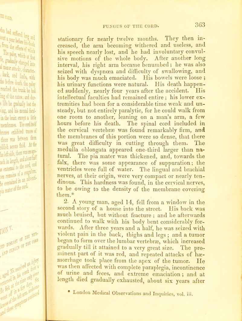 f HE t'jIlD. Slh*' I ’ fiiaj’ed into ’ W. and limls^ witli wore deatli tie wied'ietrunUeW 'B^oiAenataianddiL'- > life lie gradually lost the [iiij, and his mental faed- in the brain ejcept a little membranes. The cord itself bnnes esbibtled traces of there res - sddi'h serous W. .It the heleftslde.there®auf- [lON'' fC.Vu .five' ani”J '•.j ti®* ° stfO' klif , ilflH ,^r he^ ■ Mt llJl left“';^i.di”'‘' MS. •■ ltd®’ stationary for nearly twelve months. They then in- creased, the arm becoming withered and useless, and his speech nearly lost, and he had involuntary convul- sive motions of the whole body. After another long interval, his right arm became benumbed ; he svas also seized with dyspnoea and difficulty of ssvallowing, and his body was much emaciated. His bowels were loose ; his urinary functions were natural. His death happen- ed suddenly, nearly four years after the accident. His intellectual faculties had remained entire ; his lower ex- tremities had been for a considerable time weak and un- steady, but not entirely paralytic, for he could walk from one room to another, leaning on a man’s arm, a few hours before his death. The spinal cord included iu the cervical vertebrEE was found remarkably firm, and the membranes of this portion were so dense, that there was great difficulty in cutting through them. The medulla oblongata appeared one-third larger than na- tural. The pia mater was thickened, and, towards the falx, there was some appearance of suppuration; the ventricles were full of water. The lingual and brachial nerves, at their origin, were very compact or nearly ten- dinous. This hardness ivas found, in the cervical nerves, to be owing to the density of the membrane covering them.* 2. A young man, aged 14, fell from a window in the second story of a house into the street. His back was much bruised, hut without fracture ; and he afterwards continued to walk with his body bent considerably for- wards. After three years and a half, he was seized with violent pain in the back, thighs and legs ; and a tumor began to form over the lumbar vertebrae, which increased gradually till it attained to a very great size. The pro- minent part of it was red, and repeated attacks of he- morrhage took place from the apex of the tumor. He was then affected with complete paraplegia, incontinence ol urine and feces, and extreme emaciation ; and at length died gradually exhausted, about six years tifter • London Medical Observations and Inquiries, vol. iii.