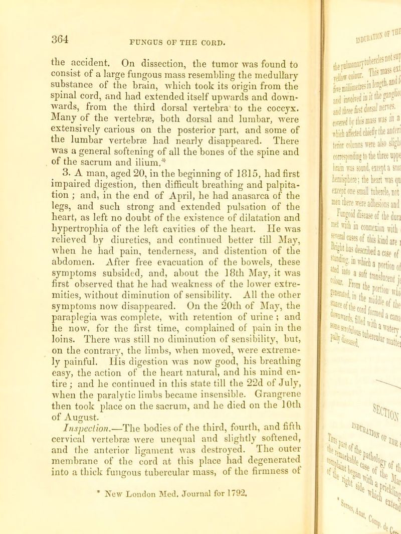 FUNGUS OF THE CORD. tlie accident. On dissection, the tumor was found to consist of a large fungous mass resembling the medullary substance of the brain, ■which took its origin from the spinal cord, and had extended itself upwards and down- wards, from the third dorsal vertebra to the coccyx. Many of the vertebrae, both dorsal and lumbar, were extensively carious on the posterior part, and some of the lumbar vertebrae had nearly disappeared. There was a general softening of all the bones of the spine and of the sacrum and ilium.* 3. A man, aged 20, in the beginning of 1815, had first impaired digestion, then difficult breathing and palpita- tion ; and, in the end of April, he had anasarca of the legs, and such strong and extended pulsation of the heart, as left no doubt of the existence of dilatation and hypertrophia of the left cavities of the heart. He was relieved by diuretics, and continued better till May, when he had pain, tenderness, and distention of the abdomen. After free evacuation of the bowels, these symptoms subsided, and, about the 18th May, it was first observed that he had weakness of the lower extre- mities, without diminution of sensibility. All the other symptoms now disappeared. On the 20th of May, the paraplegia w'as complete, Avith retention of urine ; and he now, for the first time, complained of pain in the loins. There Avas still no diminution of sensibilit}', but, on the contrary, the limbs, Avhen moved, Avere extreme- ly painful, liis digestion Avas uoav good, his breathing easy, the action of the heart natural, and his mind en- tire ; and he continued in this state till the 22d of July, Avheu the paralytic limbs became insensible. Grangrene then took place on the sacrum, and he died on the 10th of August. Inspeclion.—The bodies of the third, fourth, and fifth cervical vertebraj Avere unequal and slightly softened, and the anterior ligament was destroyed. The outer membrane of the cord at this place had degenerated into a thick fungous tubercular mass, of the firmness ot or the (nkrcles''®*-^ cord hlliis ■’ olick affected cliieiivtlieai)|m tfiioi dlutiins «re also sligf corresp ^ I'raimraswi except as teaispliere; the heart ret except one small tiiheicle, no ®n there we adhesions an f’liigoid disease of the du ttiih in connexion with J!f®es of this hind are Jtasdescrihedawpo SSa Macai New London Sled. Journal for 1792,