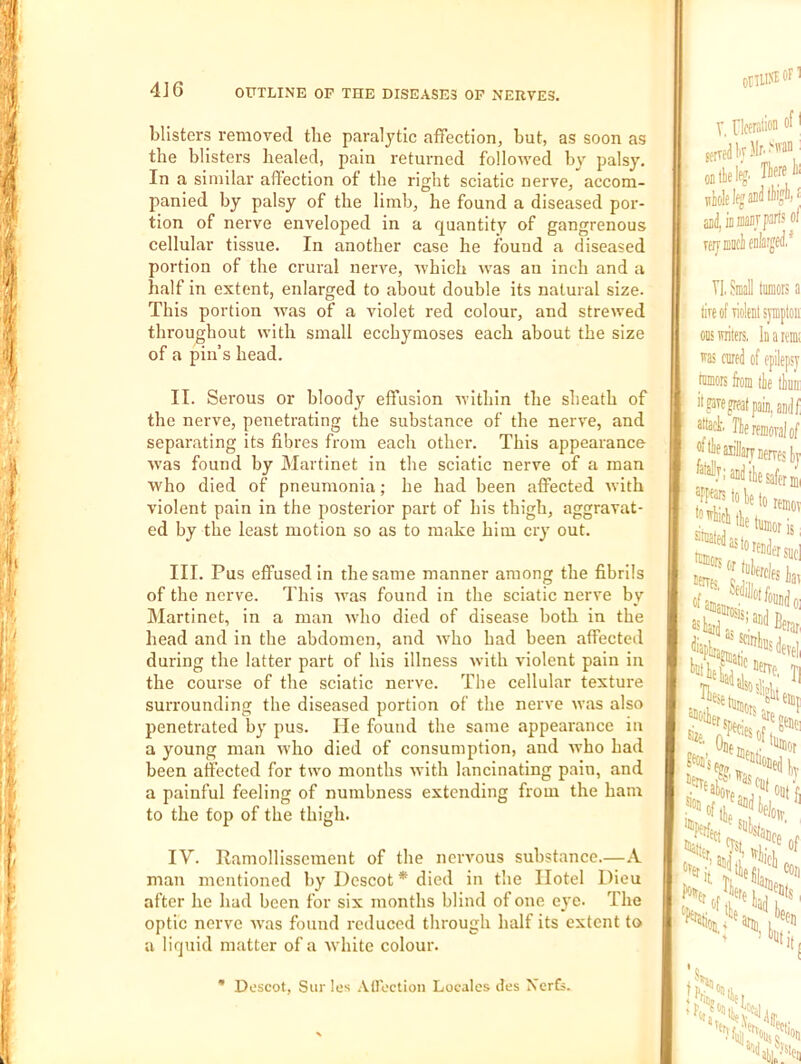 blisters removed the paralytic affection, but, as soon as the blisters healed, pain returned followed by palsy. In a similar affection of the right sciatic nerve, accom- panied by palsy of the limh, he found a diseased por- tion of nerve enveloped in a quantity of gangrenous cellular tissue. In another case he found a diseased portion of the crural nerve, which was an inch and a half in extent, enlarged to about double its natural size. This portion was of a violet red colour, and strewed throughout with small ecchymoses each about the size of a pin’s head. II. Serous or bloody effusion within the sheath of the nerve, penetrating the substance of the nerve, and separating its fibres from each other. This appearance W’as found hy Martinet in the sciatic nerve of a man who died of pneumonia; he had been affected with violent pain in the posterior part of his thigh, aggravat- ed by the least motion so as to make him cry out. III. Pus effused in the same manner among the fibrils of the nerve. This ivas found in the sciatic nerve by Martinet, in a man who died of disease both in the head and in the abdomen, and who had been affected during the latter part of his illness with violent pain in the course of the sciatic nerve. The cellular texture surrounding the diseased portion of the nerve was also penetrated by pus. He found the same appearance in a young man who died of consumption, and who had been affected for two months with lancinating pain, and a painful feeling of numbness extending from the ham to the fop of the thigh. IV. Ramollisscment of the nervous substance.—.-V man mentioned by Dcscot * died in the Hotel Dieu after he had been for six months blind of one e^'O. The optic nerve was found reduced through half its extent to a liquid matter of a white colour. onii>i OF 1 V, flceration of \ sfrdl-r}Ir.>an: on tie 1^. TieV ^yelejaiiiilWjM aii(i,iDiiiaiiJpartsof Tl, Small tumors a tireofiiobtsyniptoii CDS miters, haremi was cured of epilepsy tumors from tie liuit attack. Tie removal of jftieaiillaiTMrvestr ^baud lie safer i '“Boris; 'oa to reader sue] lerrs of as ^^.‘^'I'otfouudc Berar, :f'^“sdevel, TV ' .'’'^fSatic .A'' Bas geuei llUot 05ed iv Bfltii cui . “of,l ope.'f'it loj, i 3ru^ int 'oen .'F, “fjd Descot, Siir les .VHoction Locales des Xerts.