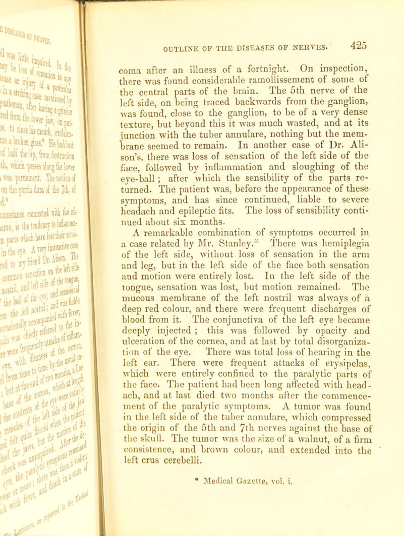 coma after an illness of a fortnight. On inspection, there was found considerable ramollissement of some of the central parts of the brain. The 5th nerve of the left side, on being traced backwards from the ganglion, was found, close to the ganglion, to be of a very dense texture, but beyond this it was much wasted, and at its junction with the tuber annulare, nothing but the mem- brane seemed to remain. In another case of Dr. Ali- son’s, there was loss of sensation of the left side of the face, followed by inflammation and sloughing of the eye-ball ; after which the sensibility of the parts re- turned. The patient was, before the appearance of these .• symptoms, and has since continued, liable to severe } headach and epileptic fits. The loss of sensibility conti- nued about six months. ? A remarkable combination of symptoms occurred in d a case related by l\Ir. Stanley.* There was hemiplegia of the left side, without loss of sensation in the arm and leg, but in the left side of the face both sensation and motion were entirely lost. In the left side of the tongue, sensation was lost, but motion remained. The mucous membrane of the left nostril wms always of a deep red colour, and there were frequent discharges of ; blood from it. The conjunctiva of the left eye became deeply injected ; this was followed by opacity and ulceration of the cornea, and at last by total disorganiza- tion of the eye. There was total loss of hearing in the left ear. There were frequent attacks of erysipelas, which were entirely confined to the paralytic parts of the face. The patient had been long atfected with head- ach, and at last died two months after the commence- ment of the paralytic symptoms. A tumor was found in the left side of the tuber annulare, which compressed the origin of the 5th and 7th nerves against the base of the skull. The tumor was the size of a walnut, of a firm consistence, and brown colour, and extended into the left crus cerebelli. Medical Gazette, vol. i.