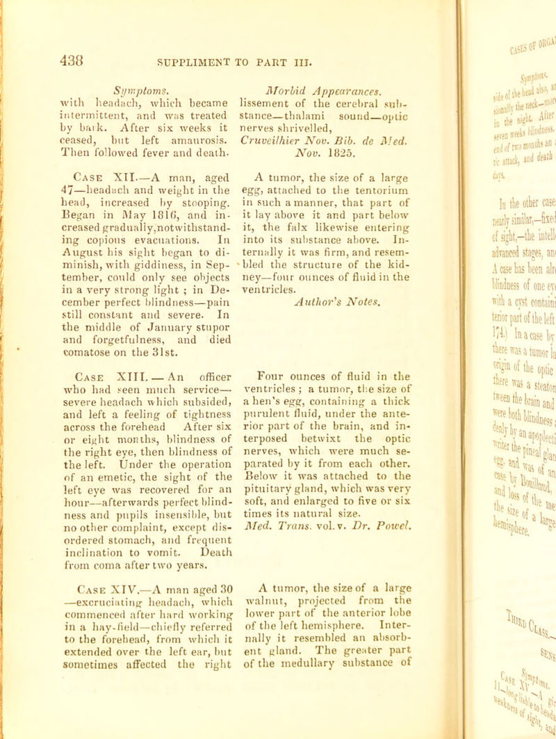 Symptoim. with headiicli, wliich became intermittent, and was treated by brnk. After six weeks it ceased, but left amaurosis. Then followed fever and death. Case XII—-A man, aged 47—headach and weight in the head, increased l)y stooping. Began in IMay 181b, and in- creased gradually, not withstand- ing copious evacuations. In August his sight began to di- minish, with giddiness, in Sep- tember, could only see objects in a very strong light ; in De- cember perfect blindness—pain still constant and severe. In the middle of January stupor and forgetfulness, and died comatose on the 31st. Case XIII. — An officer who had seen much service— severe headach which subsided, and left a feeling of tightness across the forehead After si.x or eight months, blindness of the right eye, then blindness of the left. Under the operation of an emetic, the sight of the left eye was recovered for an hour—afterwards perfect blind- ness and pupils insensible, but no other complaint, except dis- ordered stomach, and frequent inclination to vomit. Death from coma after two years. Case XIV.—A man aged 30 —excruciating headach, which commenced after hard working in a hay-lield—chiefly referred to the forehead, from wdiich it extended over the left ear, but sometimes affected the right Morbid Appearances. lissement of the cerebral sub- stance—thalami sound—optic nerves shrivelled, Cruveilhier Nov. Bib. de Med. Nov. 1825. A tumor, the size of a large egg, attached to the tentorium in such a manner, that part of it lay above it and part below it, the falx likewise entering into its substance above. In- ternally it was firm, and resem- •bled the structure of the kid- ney—four ounces of fluid in the ventricles. Author's Notes. Four ounces of fluid in the ventricles; a tumor, the size of a hen’s egg, containing a thick purulent fluid, under the ante- rior part of the brain, and in- terposed betwixt the optic nerves, which w'ere much se- parated by it from each other. Below' it was attached to the pituitary gland, which was very' soft, and enlarged to five or six times its natural size. Med. Trans, vol. v. Dr. Potcel. A tumor, the size of a large w'alnut, projected from the lower part of the anterior lobe of the left hemisphere. Inter- nally it resembled an absorb- ent gland. The greater part of the medullary substance of