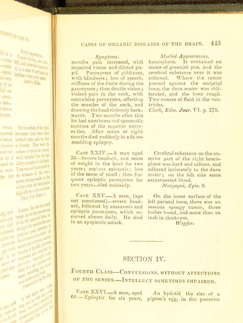 —'aittii. fj,®miiiilj. f| I i)v jL^ jVto, :nili r» fonnii. i »ii- ! jl«m» 'm mrtn. tiiT.M, On t'e nitife f< tie lijlii i'T<*>w Mmiiniere there »ere three 'j'lir.i. h.jrie'i^ ipoB. esch ea kh ■■: ‘ ne in ditrarter. They rrere the >; .la- turfjtti of tnhertrljr Mter. s.i H fh4 estenW * T:.re-ot:. r f-'ir tke H the Symptoms. months jiain increased, with impaired vision and dilated pu- pil. Paroxysms of giddiness, with blindness; loss of speech, stiffness of the limlrs during the paroxysms ; then double vision ; violent pain in the neck, with convulsive paroxysms, affecting the muscles of the neck, and drawing thehead violently back- wards. Two months after this he had numbness and spasmodic motions of the superior extre- m.ties. After seven or eight months died suddenly in a fit re* sembling epilepsy. Case XXIV—A man aged 35—Severe headach, and sense of weight in the head for two years; cop'ous epistaxis ; loss of the sense of smell ; then fre- quent epileptic paroxysms for two years—died suddenly. Case XXV.—.A man, (age not mentioned)—severe head- ach, followed by amaurosis and epileptic paroxysms, which oc- curred almost daily. He died in an apoplectic attack. Mnrhxd Appearances. hemisphere. It contained an ounce of greenish pus, and the cerebral substance near it was softened. Where the tumor pre.<sed against the occipital bone, the dura mater was obli- terated, and the bone rough. Two ounces of fluid in the ven- tricles. Clerk, Edin. Jour. VI. p. 275. Cerebral substance on the an- terior part of the right hemis- phere was hard and callous, and adhered intimately to the dura mater; on the left side some extravasated blood. JMoryagni, Epis. 0. On the inner surface of the left parietal bone, there was an osseous spongy tumor, three inches broad, and more than an inch in thickness. IVepfer. SECTION IV. Fourth Class—Convulsions, without affections OF THE senses. INTELLECT SOjMETIMES IMPAIRED. —A man, aged An hydatid the size of a bO — Epileptic lor six years, pigeon’s egg, in the posterior