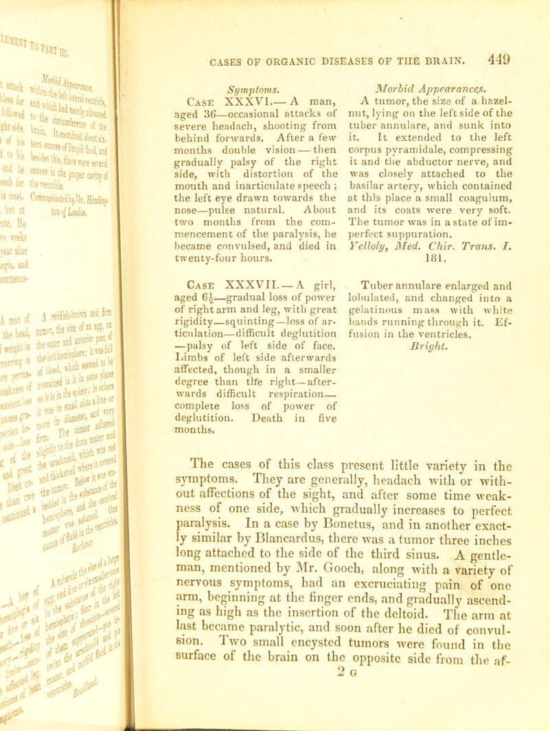 f ■ Symptoms. Case XXXVI— A man, aged 36—occasional attacks of severe headach, shooting from behind forwards. After a few months double vision — then gradually palsy of the right side, with distortion of the mouth and inarticulate speech ; the left eye drawn towards the nose—pulse natural. About two months from the com- mencement of the paralysis, he became convulsed, and died in twenty-four hours. Case XXXVII.—A girl, aged 64—gradual loss of power of right arm and leg, with great rigidity—squinting—loss of ar- ticulation—difficult deglutition —palsy of left side of face, liimbs of left side afterwards affected, though in a smaller degree than the right—after- wards difficult respiration— complete loss of power of deglutition. Death in five months. Morbid Appearanccis. A tumor, the size of a hazel- nut, lying on the left side of the tuber annulare, and sunk into it. It extended to the left corpus pyramidale, compressing it and the abductor nerve, and was closely attached to the basilar artery, which contained at this place a small coagulum, and its coats were very soft. The tumor was in a state of im- perfect suppuration. Velloly, Med. Chir. Trans. I. 181. Tuber annulare enlarged and loluilated, and changed into a gelatinous mass with white liauds running through it. Ef- fusion in the ventricles. Bright. The cases of this class present little variety in the symptoms. They are generally, headach with or with- out affections of the sight, and after some time weak- ness of one side, Avhich gradually increases to perfect paralysis. In a case by Bonetus, and in another exact- ly similar by Blancardus, there was a tumor three inehes long attached to the side of the third sinus. A gentle- man, mentioned by j\Ir. Gooch, along with a variety of nervous symptoms, had an excruciating pain of one arm, beginning at the finger ends, and gradually ascend- ing as high as the insertion of the deltoid. The arm at last became paralytic, and soon after he died of convul- sion. Two small encysted tumors were found in the surface of the brain on the opposite side from the af- 2 o