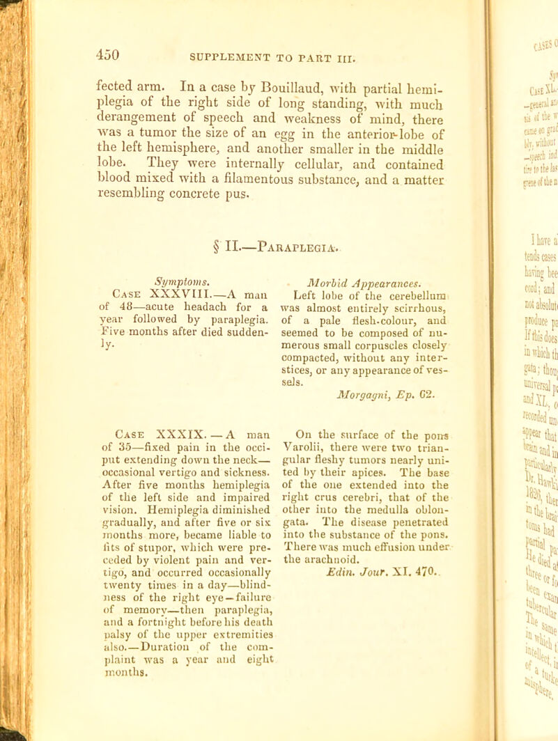 fected arm. Iq a case by Bouillaud, with partial hemi- plegia of the right side of long standing, with much derangement of speech and weakness of mind, there was a tumor the size of an egg in the anterior-lobe of the left hemisphere, and another smaller in the middle lobe. They were internally cellular, and contained blood mixed with a filamentous substance, and a matter resembling concrete pus. § II—Paraplegia. Symptoms. Case XXXVtil A man of 48—acute headach for a year followed by paraplegia. Five months after died sudden- ly- Case XXXIX.—A man of 35—fixed pain in the occi- put extending down the neck— occasional vertigo and sickness. After five months hemiplegia of the left side and impaired vision. Hemiplegia diminished gradually, and after five or six months more, became liable to fits of stupor, which were pre- ceded by violent pain and ver- tigo, and occurred occasionally twenty times in a day—blind- ness of the right eye —failure of memory—then paraplegia, and a fortnight before his death palsy of the upper extremities also Duration of the com- plaint was a year aiid eight months. Morbid Appearances. Left lobe of the cerebellum was almost entirely scirrhous, of a pale flesh, colour, and seemed to be composed of nu- merous small corpuscles closely compacted, without any inter- stices, or any appearance of ves- sels. Morgagni, Ep. G2. On the surface of the pons Varolii, there were tw'o trian- gular fleshy tumors nearly uni- ted by their apices. The base of the one extended into the right crus cerebri, that of the other into the medulla oblon- gata. The disease penetrated into the substance of the pons. There was much effusion under the arachnoid. Edin, Jour. XI. 470.