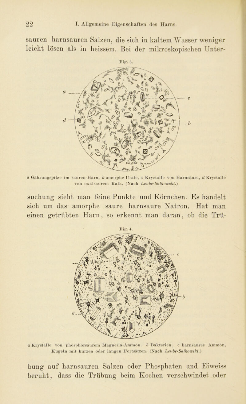 sauren harnsauren Salzen, die sich in kaltem AVasser weniger leicht lösen als in heissera. Bei der mikroskopischen Unfer- tig. 3. a Gährungspilze im sauren Harn, b amorphe Urate, c Krystalle von Harnsäure, d Kry stalle von oxalsaurem Kalk. (Nach Leube-Salkoivski.) suchung sieht man feine Punkte und Körnchen. Es handelt sich um das amorphe saure harnsaure Natron. Hat man einen getrübten Harn, so erkennt man daran, ob die Trü- Fig.4. a Krystalle von phosphorsaurem Magnesia-Ammon, b Bakterien, c harnsaures Ammon, Kugeln mit kurzen oder langen Fortsätzen. (Nach Lev.be-Salkowslii.) bung auf harnsauren Salzen oder Phosphaten und Eiweiss beruht, dass die Trübung beim Kochen verschwindet oder