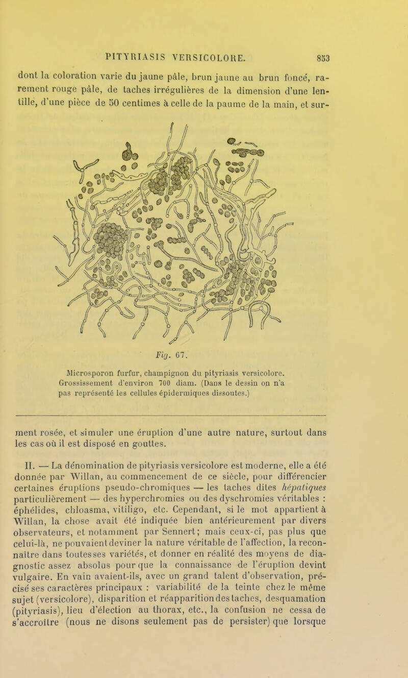 dont la coloration varie du jaune pâle, brun jaune au brun foncé, ra- rement rouge pâle, de taches irrégulières de la dimension d'une len- tille, d'une pièce de 50 centimes à celle de la paume de la main, et sur- Firj. 07. Microsporon furfur, champignon du pityriasis versicolorc. Grossissement d'environ 700 diam. (Dans le dessin on n'a pas représenté les cellules épidermiqucs dissoutes.) ment rosée, et simuler une éruption d'une autre nature, surtout dans les cas où il est disposé en gouttes. II. — La dénomination de pityriasis versicolore est moderne, elle a été donnée par Willan, au commencement de ce siècle, pour différencier certaines éruptions pseudo-chromiques — les taches dites hépatiques particulièrement — des hyperchromies ou des dyschromies véritables : éphélides, chloasma, vitiligo, etc. Cependant, si le mot appartient à Willan, la chose avait été indiquée bien antérieurement par divers observateurs, et notamment parSennert; mais ceux-ci, pas plus que celui-là, ne pouvaient deviner la nature véritable de l'affection, la recon- naître dans toutes ses variétés, et donner en réalité des moyens de dia- gnostic assez absolus pour que la connaissance de l'éruption devint vulgaire. En vain avaient-ils, avec un grand talent d'observation, pré- cisé ses caractères principaux : variabilité delà teinte chez le même sujet (versicolore), disparition et réapparition des taches, desquamation (pityriasis), lieu d'élection au thorax, etc., la confusion ne cessa de s'accroilre (nous ne disons seulement pas de persister) que lorsque