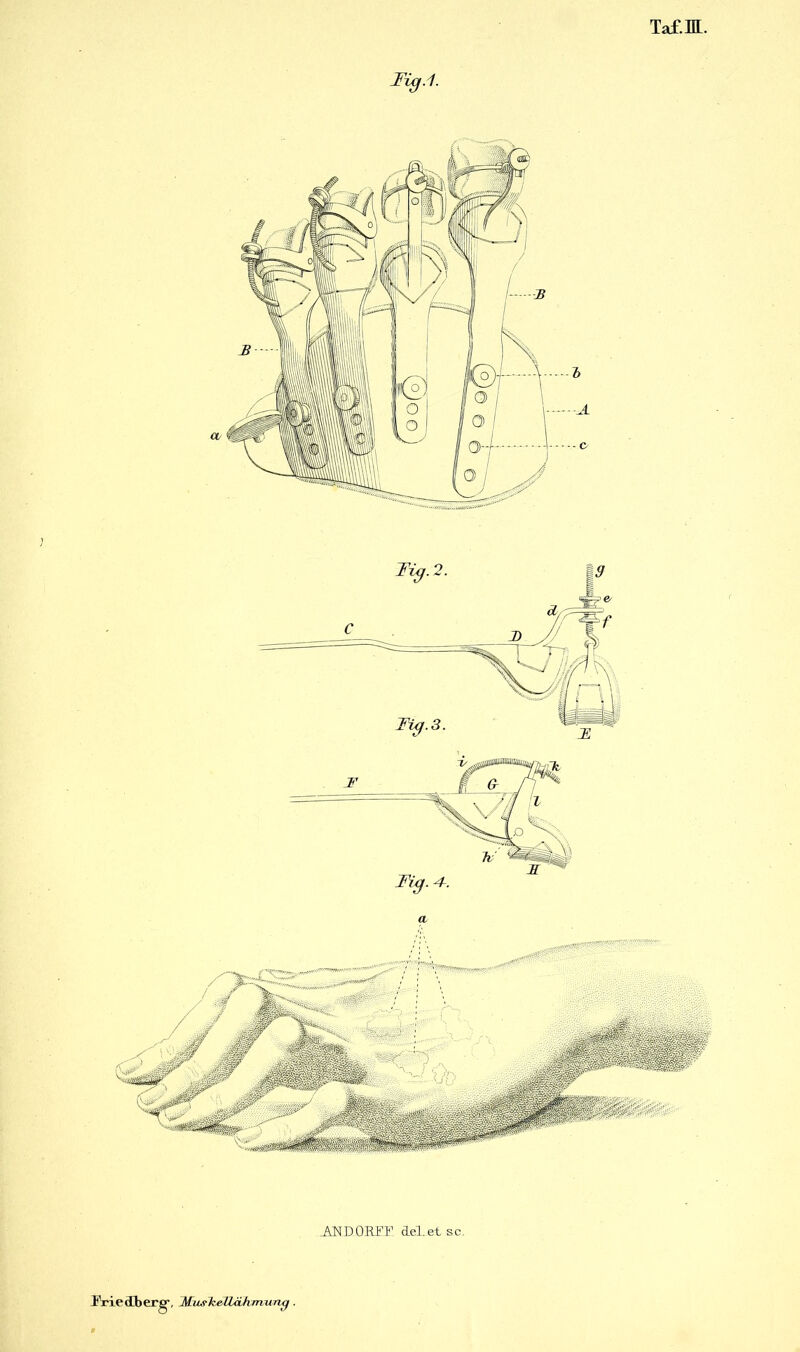 Taf-ffl. Mg. 4-. a ANDORTF del.et sc. •, MusTzelUikmunß.