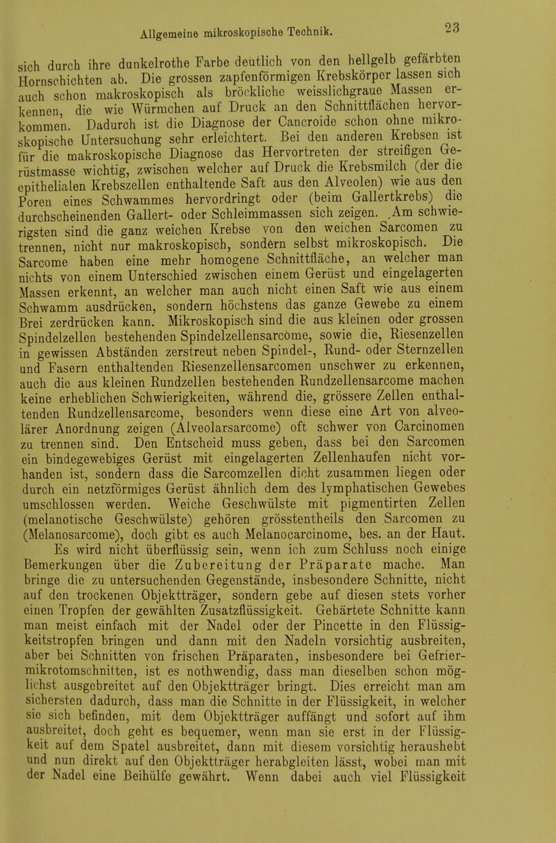 sich durch ihre dunkelrothe Farbe deutlich von den hellgelb gefärbten Hornschichten ab. Die grossen zapfen förmigen Krebskörper lassen sich auch schon makroskopisch als bröckliche weisslichgraue Massen er- kennen die wie Würmchen auf Druck an den Schnittflächen hervor- kommen Dadurch ist die Diagnose der Cancroide schon ohne mikro- skopische Untersuchung sehr erleichtert. Bei den anderen Krebsen ist für die makroskopische Diagnose das Hervortreten der streifigen (xe- rüstmasse wichtig, zwischen welcher auf Druck die Krebsmilch (der die epithelialen Krebszellen enthaltende Saft aus den Alveolen) wie aus den Poren eines Schwammes hervordringt oder (beim Gallertkrebs) die durchscheinenden Gallert- oder Schleimmassen sich zeigen. ,Am schwie- rigsten sind die ganz weichen Krebse von den weichen Sarcomen zu trennen, nicht nur makroskopisch, sondern selbst mikroskopisch. Die Sarcome haben eine mehr homogene Schnittfläche, an welcher man nichts von einem Unterschied zwischen einem Gerüst und eingelagerten Massen erkennt, an welcher man auch nicht einen Saft wie aus einem Schwamm ausdrücken, sondern höchstens das ganze Gewebe zu einem Brei zerdrücken kann. Mikroskopisch sind die aus kleinen oder grossen Spindelzellen bestehenden Spindelzellensarcöme, sowie die, Riesenzellen in gewissen Abständen zerstreut neben Spindel-, Rund- oder Sternzellen und Fasern enthaltenden Riesenzellensarcomen unschwer zu erkennen, auch die aus kleinen Rundzellen bestehenden Rundzellensarcome machen keine erheblichen Schwierigkeiten, während die, grössere Zellen enthal- tenden Rundzellensarcome, besonders wenn diese eine Art von alveo- lärer Anordnung zeigen (Alveolarsarcome) oft schwer von Carcinomen zu trennen sind. Den Entscheid muss geben, dass bei den Sarcomen ein bindegewebiges Gerüst mit eingelagerten Zellenhaufen nicht vor- handen ist, sondern dass die Sarcomzellen dicht zusammen liegen oder durch ein netzförmiges Gerüst ähnlich dem des lymphatischen Gewebes umschlossen werden. Weiche Geschwülste mit pigmentirten Zellen (melanotische Geschwülste) gehören grösstentheils den Sarcomen zu (Melanosarcome), doch gibt es auch Melanocarcinome, bes. an der Haut. Es wird nicht überflüssig sein, wenn ich zum Schluss noch einige Bemerkungen über die Zubereitung der Präparate mache. Man bringe die zu untersuchenden Gegenstände, insbesondere Schnitte, nicht auf den trockenen Objektträger, sondern gebe auf diesen stets vorher einen Tropfen der gewählten Zusatzflüssigkeit. Gehärtete Schnitte kann man meist einfach mit der Nadel oder der Pincette in den Flüssig- keitstropfen bringen und dann mit den Nadeln vorsichtig ausbreiten, aber bei Schnitten von frischen Präparaten, insbesondere bei Gefrier- mikrotomschnitten, ist es nothwendig, dass man dieselben schon mög- lichst ausgebreitet auf den Objektträger bringt. Dies erreicht man am sichersten dadurch, dass man die Schnitte in der Flüssigkeit, in welcher sie sich befinden, mit dem Objektträger auffängt und sofort auf ihm ausbreitet, doch geht es bequemer, wenn man sie erst in der Flüssig- keit auf dem Spatel ausbreitet, dann mit diesem vorsichtig heraushebt und nun direkt auf den Objektträger herabgleiten lässt, wobei man mit der Nadel eine Beihülfe gewährt. Wenn dabei auch viel Flüssigkeit