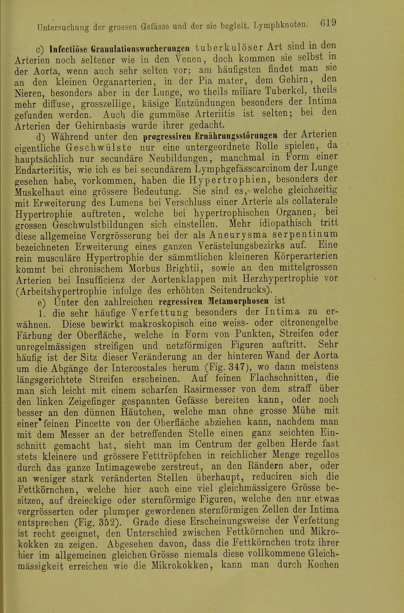 c) liifcctiösc Grauulationswiichcruiigcn tuberkulöser Art sind in den Arterien noch seltener wie in den Venen, docli kommen sie selbst in der Aorta, wenn auch sehr selten vor; am häufigsten findet man sie an den kleinen Organarterien, in der Pia mater, dem Gehirn, den Nieren, besonders aber in der Lunge, wo theils miliare Tuberkel, theils mehr diffuse, grosszellige, käsige Entzündungen besonders der Intima gefunden werden. Auch die gummöse Arteriitis ist selten; bei den Arterien der Gehirnbasis wurde ihrer gedacht. d) Während unter den progressiTCii Ernährungsstörungen der Arterien eigentliche Geschwülste nur eine untergeordnete Rolle spielen, da hauptsächlich nur secundäre Neubildungen, manchmal in Form einer Endarteriitis, wie ich es bei secundärem Lymphgefässcarcinom der Lunge gesehen habe, vorkommen, haben die Hypertrophien, besonders der Muskelhaut eine grössere Bedeutung. Sie sind es, welche gleichzeitig mit Erweiterung des Lumens bei Verschluss einer Arterie als coUaterale Hypertrophie auftreten, welche bei hypertrophischen Organen, bei grossen Geschwulstbildungen sich einstellen. Mehr idiopathisch tritt diese allgemeine Vergrösserung bei der als Aneurysma serpentinum bezeichneten Erweiterung eines ganzen Verästelungsbezirks auf. Eine rein musculäre Hypertrophie der sämmtlichen kleineren Körperarterien kommt bei chronischem Morbus Brightii, sowie an den mittelgrossen Arterien bei Insufficienz der Aortenklappen mit Herzhypertrophie vor (Arbeitshypertrophie infolge des erhöhten Seitendrucks). e) Unter den zahlreichen regressircn Metamorphosen ist 1. die sehr häufige Verfettung besonders der Intima zu er- wähnen. Diese bewirkt makroskopisch eine weiss- oder citronengelbe Färbung der Oberfläche, welche in Form von Punkten, Streifen oder unregelmässigen streifigen und netzförmigen Figuren auftritt. Sehr häufig ist der Sitz dieser Veränderung an der hinteren Wand der Aorta um die Abgänge der Intercostales herum (Fig. 347), wo dann meistens längsgerichtete Streifen erscheinen. Auf feinen Plachschnitten, die man sich leicht mit einem scharfen Rasirmesser von dem straff über den linken Zeigefinger gespannten Gefässe bereiten kann, oder noch besser an den dünnen Häutchen, welche man ohne grosse Mühe mit einer* feinen Pincette von der Oberfläche abziehen kann, nachdem man mit dem Messer an der betreffenden Stelle einen ganz seichten Ein- schnitt gemacht hat, sieht man im Centrum der gelben Herde fast stets kleinere und grössere Fetttröpfchen in reichlicher Menge regellos durch das ganze Intimagewebe zerstreut, an den Rändern aber, oder an weniger stark veränderten Stellen überhaupt, reduciren sich die Fettkörnchen, welche hier auch eine viel gleichmässigere Grösse be- sitzen, auf dreieckige oder sternförmige Figuren, welche den nur etwas vergrösserten oder plumper gewordenen sternförmigen Zellen der Intima entsprechen (Fig. 352). Grade diese Erscheinungsweise der Verfettung ist recht geeignet, den Unterschied zwischen Fettkörnchen und Mikro- kokken zu zeigen. Abgesehen davon, dass die Fettkörnchen trotz ihrer hier im allgemeinen gleichen Grösse niemals diese vollkommene Gleich- mässigkeit erreichen wie die Mikrokokken, kann man durch Kochen