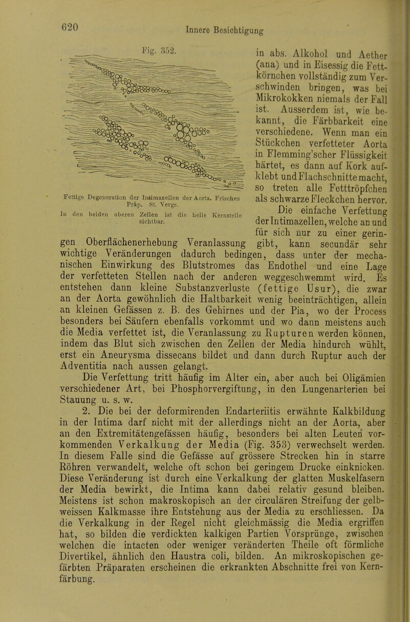 in abs. Alkohol und Aether (ana) und in Eisessig die Fett- körnchen vollständig zum Ver- schwinden bringen, was bei Mikrokokken niemals der Fall ist. Ausserdem ist, wie be- kannt, die Färbbarkeit eine verschiedene. Wenn man ein Stückchen verfetteter Aorta in Flemming'scher Flüssigkeit härtet, es dann auf Kork auf- klebt und Flachschnitte macht, so treten alle Fetttröpfchen als schwarze Fleckchen hervor. Die einfache Verfettung der Intimazellen, welche an und für sich nur zu einer gerin- gibt, kann secundär sehr wichtige Veränderungen dadurch bedingen, dass unter der mecha- nischen Einwirkung des Blutstromes das Endothel und eine Lage der verfetteten Stellen nach der anderen weggeschwemmt wird. Es entstehen dann kleine Substanzverluste (fettige Usur), die zwar an der Aorta gewöhnlich die Haltbarkeit wenig beeinträchtigen, allein an kleinen Gefässen z. B. des Gehirnes und der Pia, wo der Process besonders bei Säufern ebenfalls vorkommt und wo dann meistens auch die Media verfettet ist, die Veranlassung zu Rupturen werden können, indem das Blut sich zwischen den Zellen der Media hindurch wühlt, erst ein Aneurysma dissecans bildet und dann durch Ruptur auch der Adventitia nach aussen gelangt. Die Verfettung tritt häufig im Alter ein, aber auch bei Oligämien verschiedener Art, bei Phosphorvergiftung, in den Lungenarterien bei Stauung u. s. w. 2. Die bei der deformirenden Endarteriitis erwähnte Kalkbildung in der Intima darf nicht mit der allerdings nicht an der Aorta, aber an den Extremitätengefässen häufig, besonders bei alten Leuten vor- kommenden Verkalkung der Media (Fig. 353) verwechselt werden. In diesem Falle sind die Gefässe auf grössere Strecken hin in starre Röhren verwandelt, welche oft schon bei geringem Drucke einknicken. Diese Veränderung ist durch eine Verkalkung der glatten Muskelfasern der Media bewirkt, die Intima kann dabei relativ gesund bleiben. Meistens ist schon makroskopisch an der circulären Streifung der gelb- weissen Kalkmasse ihre Entstehung aus der Media zu erschliessen. Da die Verkalkung in der Regel nicht gleichmässig die Media ergriffen hat, so bilden die verdickten kalkigen Partien Vörsprünge, zwischen welchen die intacten oder weniger veränderten Theile oft förmliche Divertikel, ähnlich den Haustra coli, bilden. An mikroskopischen ge- färbten Präparaten erscheinen die erkrankten Abschnitte frei von Kern- färbung. Fig. 352. Fettige Degenerntion der Intiraazelleii der Aorta. Frisclies Präp. St. Vergr. In den beiden oberen Zellen ist die helle Kernstelle siclitbar. gen Oberflächenerhebung Veranlassung