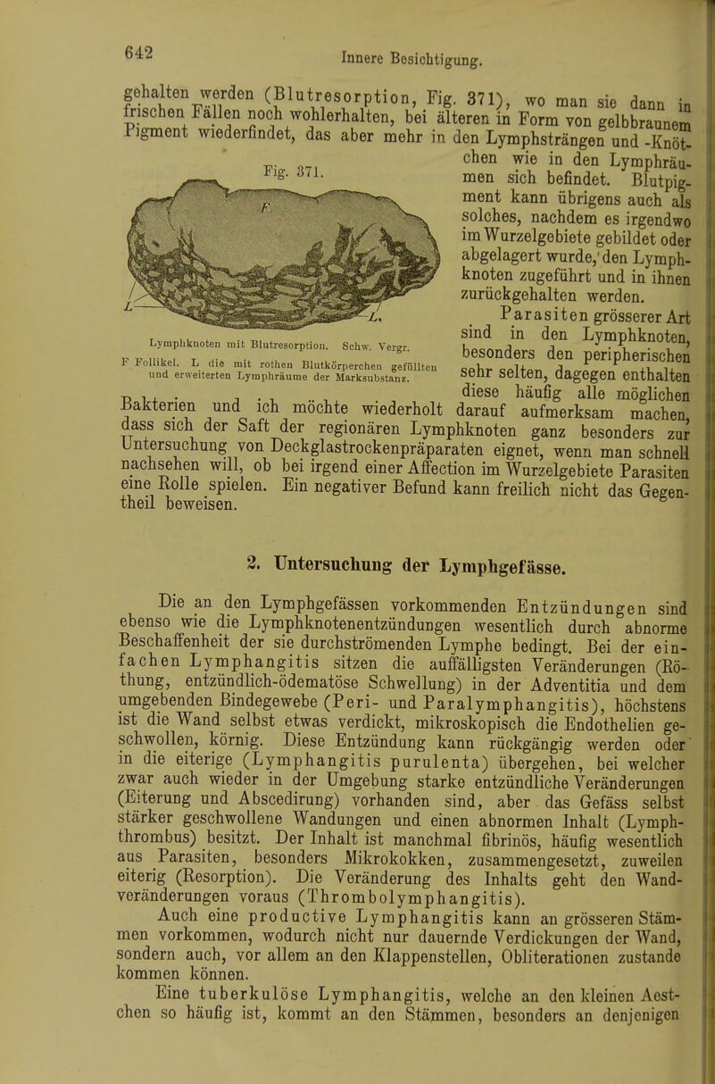 gehalten werden (Blutresorption, Fig. 371), wo man sie dann in frischen Fallen noch wohlerhalten, bei älteren in Form von gelbbraunem Pigment wiederfindet, das aber mehr in den Lymphsträngen und -Knö^ c^eii wie in den Lymphräu- ^ sich befindet. Biutpig. ment kann übrigens auch als solches, nachdem es irgendwo im Wurzelgebiete gebildet oder abgelagert wurde,' den Lymph- knoten zugeführt und in ihnen zurückgehalten werden. ^ Parasiten grösserer Art ,, . . „ sind in den Lymphknoten Lymphknoten mit Blutresorption. Schw. Vergr U^o« J j *' • 'S ^^^> F Fniiii-M T : L . . besonders den peripherischen F Follikel. L die mit rothen Blutkörperchen gefüllten ca\^r. o,^U A xi i, und erweiterten Lymphräume der Marksubstanz. ^^ SeiieU, aagOgeU enthalten Tj 1 . . j . T. .. , . . , diese häufig alle möglichen Bakterien und ich mochte wiederholt darauf aufmerksam machen dass sich der Saft der regionären Lymphknoten ganz besonders zur Untersuchung von Deckglastrockenpräparaten eignet, wenn man schneU nachsehen will, ob bei irgend einer Affection im Wurzelgebiete Parasiten eine Kolle spielen. Ein negativer Befund kann freilich nicht das Gegen- theil beweisen. 2. Untersuchung der Lymphgefässe. Die an den Lymphgefässen vorkommenden Entzündungen sind ebenso wie die Lymphknotenentzündungen wesentlich durch abnorme Beschaffenheit der sie durchströmenden Lymphe bedingt. Bei der ein- fachen Lymphangitis sitzen die auffälligsten Veränderungen (Rö- thung, entzündlich-ödematöse Schwellung) in der Adventitia und dem umgebenden Bindegewebe (Peri- und Paralymphangitis), höchstens ist die Wand selbst etwas verdickt, mikroskopisch die Endothelien ge- schwollen, körnig. Diese Entzündung kann rückgängig werden oder' in die eiterige (Lymphangitis purulenta) übergehen, bei welcher zwar auch wieder in der Umgebung starke entzündliche Veränderungen (Eiterung und Abscedirung) vorhanden sind, aber das Gefäss selbst stärker geschwollene Wandungen und einen abnormen Inhalt (Lymph- thrombus) besitzt. Der Inhalt ist manchmal fibrinös, häufig wesentlich aus Parasiten, besonders JMiikrokokken, zusammengesetzt, zuweilen eiterig (Resorption). Die Veränderung des Inhalts geht den Wand- veränderungen voraus (Thrombolymphangitis). Auch eine productive Lymphangitis kann an grösseren Stäm- men vorkommen, wodurch nicht nur dauernde Verdickungen der Wand, sondern auch, vor allem an den Klappenstellen, Obliterationen zustande kommen können. Eine tuberkulöse Lymphangitis, welche an den kleinen Aest- chen so häufig ist, kommt an den Stämmen, besonders an denjenigen