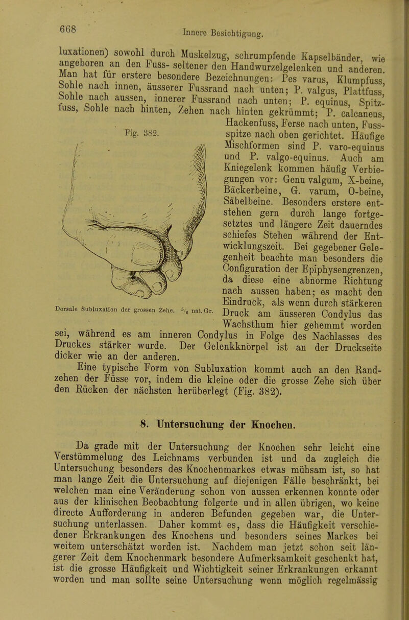 luxationen) sowohl durch Muskelzug, schrumpfende Kapselbänder, wie angeboren an den Fuss- seltener den Handwurzelgelenken und anderen. Man hat für erstero besondere Bezeichnungen: Pes varus, Klumpfuss bohle nach innen, äusserer Fussrand nach unten; P. valgus, Plattfuss' bohle nach aussen mnerer Fussrand nach unten; P. equinus, Snitz- luss, Sohle nach hinten, Zehen nach hinten gekrümmt; P. calcaneus, Hackenfuss, Ferse nach unten, Fuss- ^^S- 382. spitze nach oben gerichtet. Häufige Mischformen sind P. varo-equinus und P. valgo-equinus. Auch am Kniegelenk kommen häufig Verbie- gungen vor: Genu valgum, X-beine, Bäckerbeine, G. varum, 0-beine, Säbelbeine. Besonders erstere ent- stehen gern durch lange fortge- setztes und längere Zeit dauerndes schiefes Stehen während der Ent- wicklungszeit. Bei gegebener Gele- genheit beachte man besonders die Configuration der Epiphysengrenzen, da diese eine abnorme Richtung nach aussen haben; es macht den Eindruck, als wenn durch stärkeren Druck am äusseren Condylus das Wachsthum hier gehemmt worden sei, während es am inneren Condylus in Folge des Nachlasses des Druckes stärker wurde. Der Gelenkknörpe.l ist an der Druckseite dicker wie an der anderen. Eine typische Form von Subluxation kommt auch an den Rand- zehen der Füsse vor, indem die kleine oder die grosse Zehe sich über den Rücken der nächsten herüberlegt (Fig. 382). Dorsale Subluxation der grossen Zehe. ^/^ nat. Gr. 8. TJntersucliuiig der Knochen. Da grade mit der Untersuchung der Knochen sehr leicht eine Verstümmelung des Leichnams verbunden ist und da zugleich die Untersuchung besonders des Knochenmarkes etwas mühsam ist, so hat man lange Zeit die Untersuchung auf diejenigen Fälle beschränkt, bei welchen man eine Veränderung schon von aussen erkennen konnte oder aus der klinischen Beobachtung folgerte und in allen übrigen, wo keine directe Aufforderung in anderen Befunden gegeben war, die Unter- suchung unterlassen. Daher kommt es, dass die Häufigkeit verschie- dener Erkrankungen des Knochens und besonders seines Markes bei weitem unterschätzt worden ist. Nachdem man jetzt schon seit län- gerer Zeit dem Knochenmark besondere Aufmerksamkeit geschenkt hat, ist die grosse Häufigkeit und Wichtigkeit seiner Erkrankungen erkannt worden und man sollte seine Untersuchung wenn möglich regelmässig